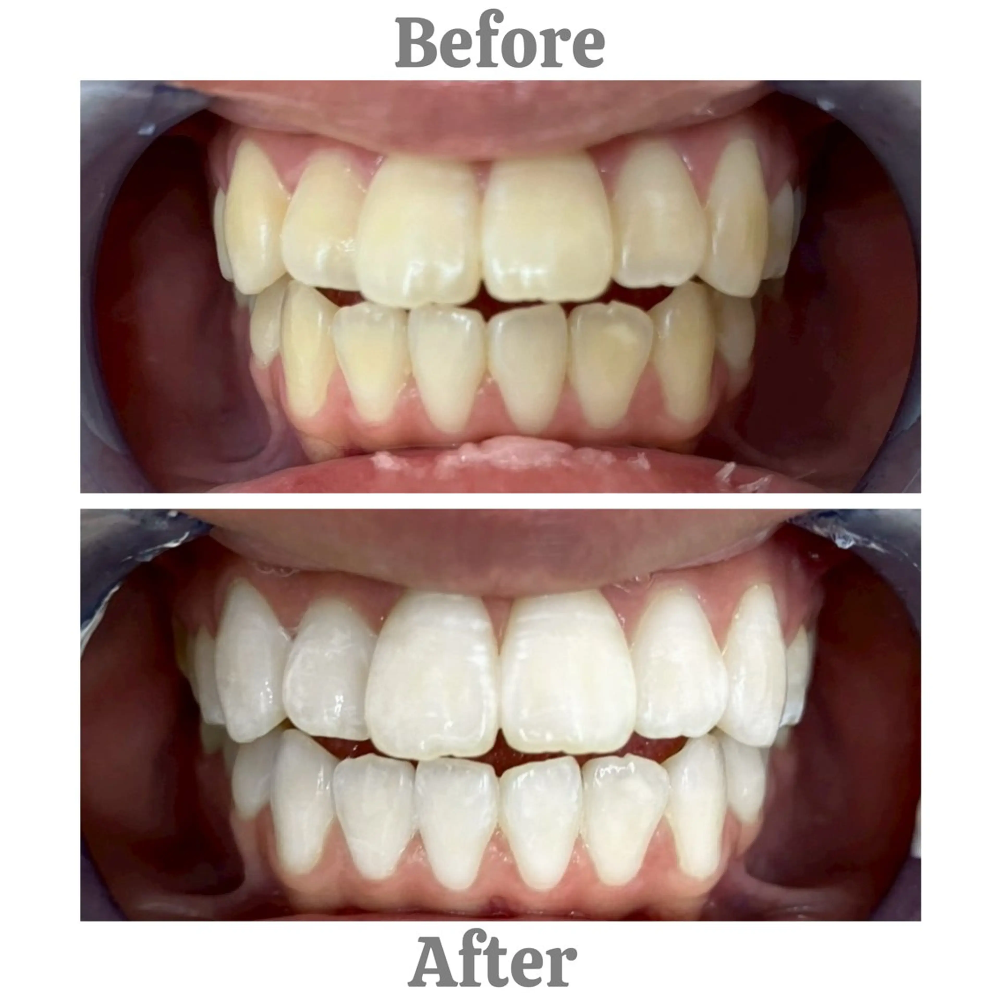 セルフホワイトニング エクシア相模大野店所属・mo moのその他イメージ