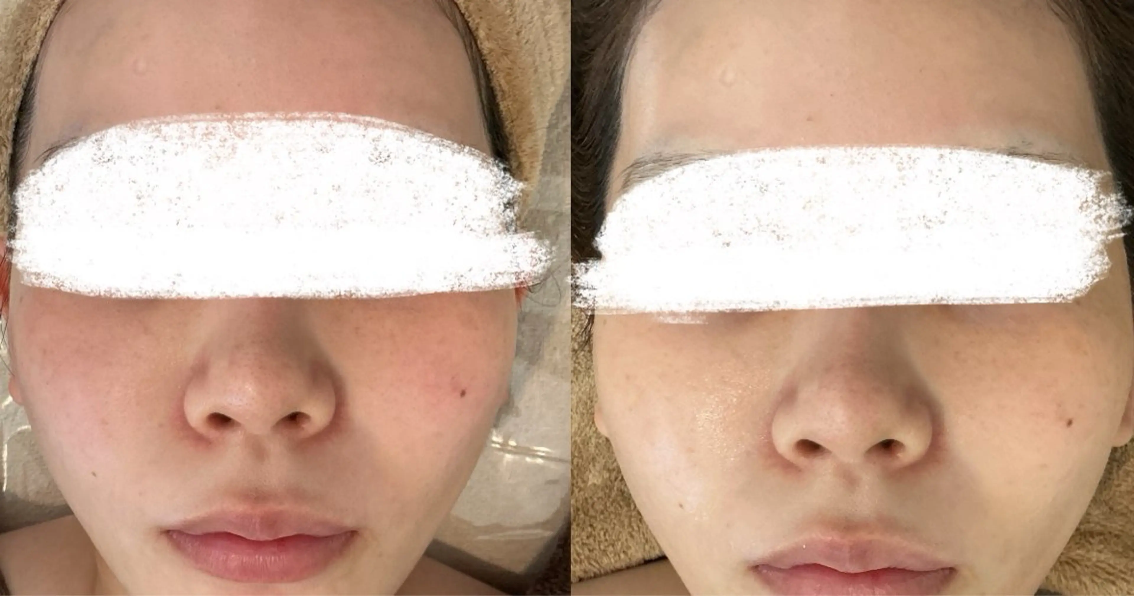 エステ 美肌脱毛と癒しのプライベートサロン。gratia~グレイティア~所属・gratia ~グレイティア~のエステ・リラクイメージ