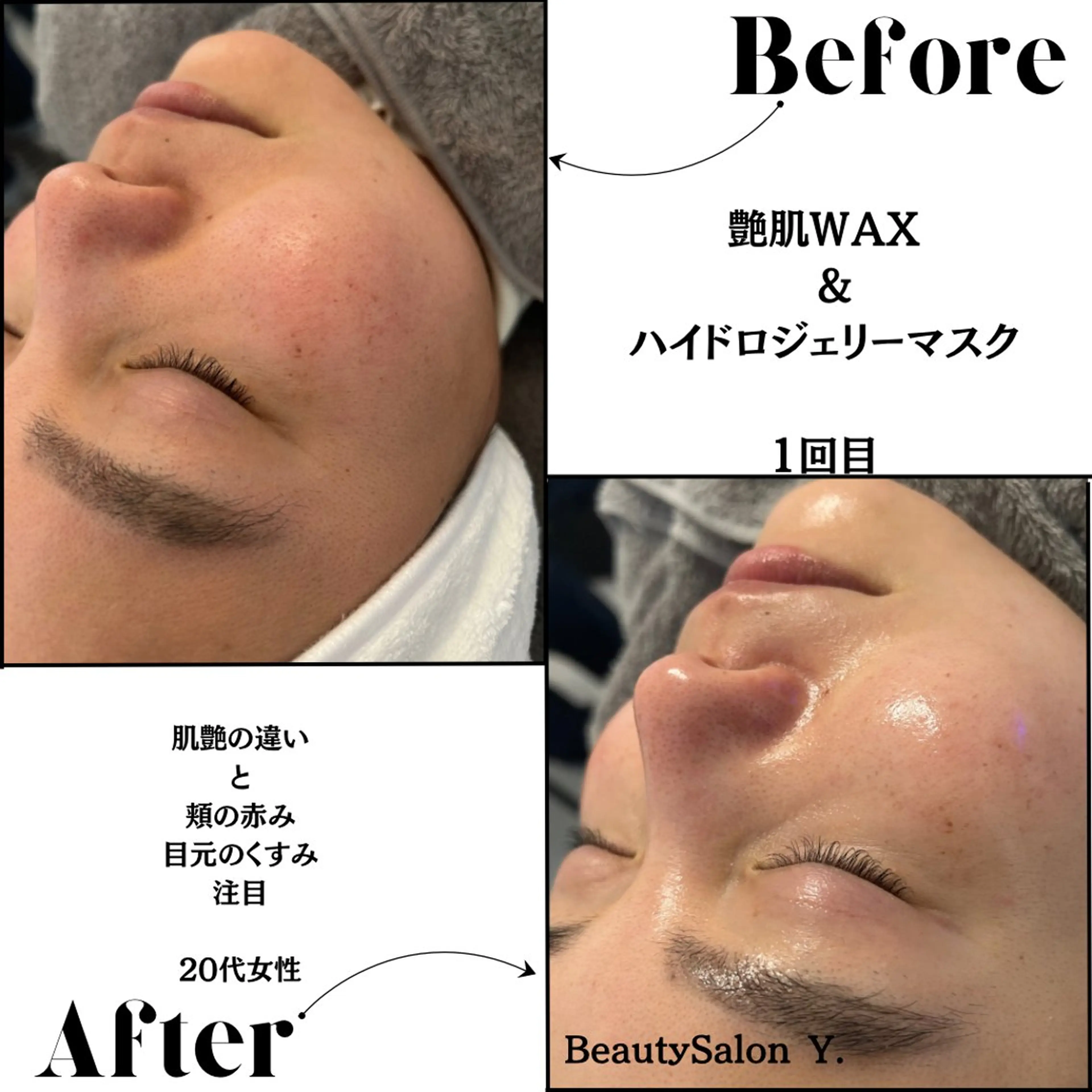 その他 体質／肌質改善専門店 Y.【ワイドット】のエステ・リラクイメージ