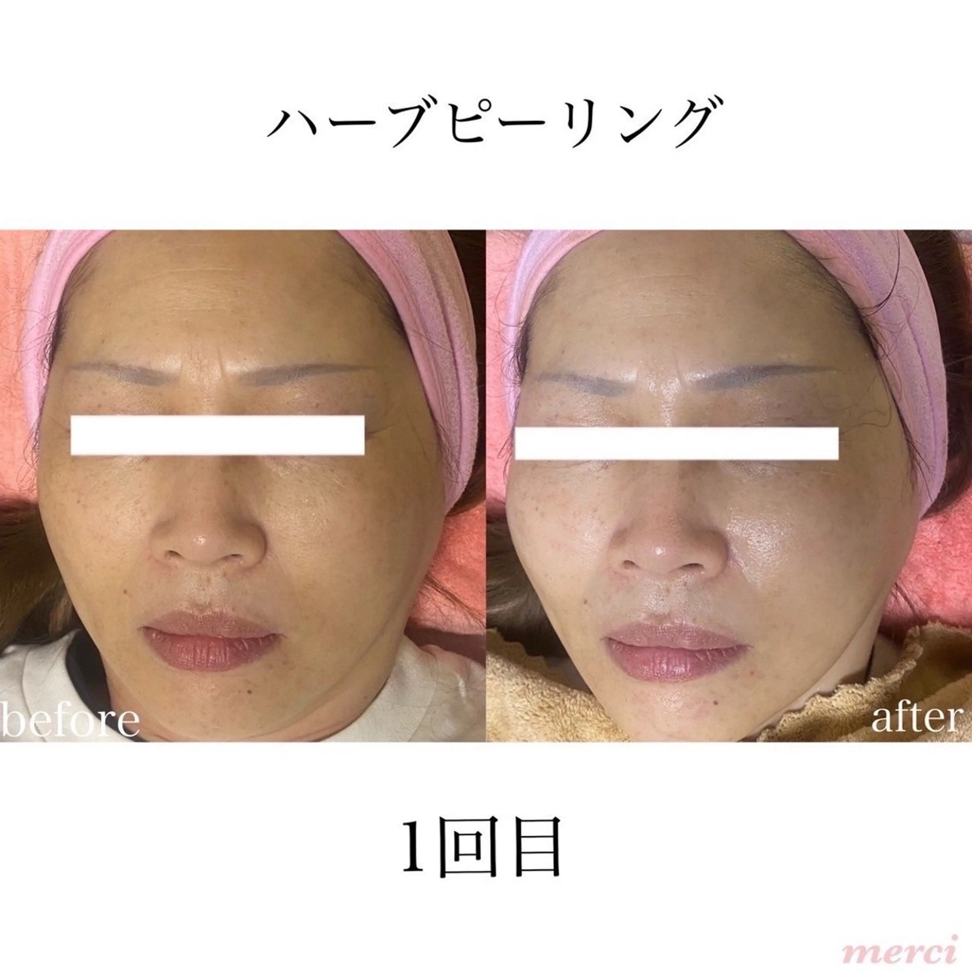 salon merciのエステ・リラクイメージ