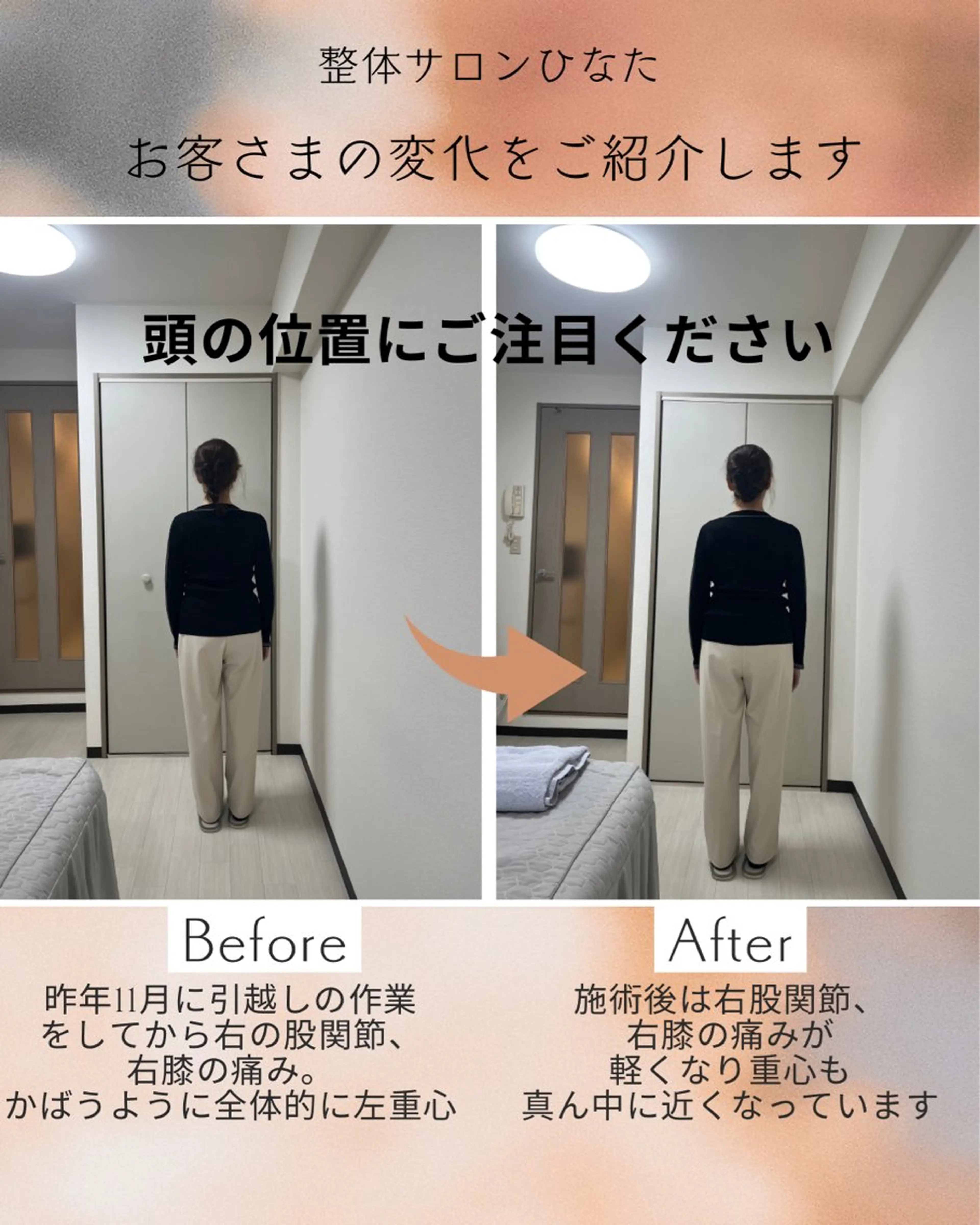 整体サロン　ひなた~HINATA~ 　京阪七条　京都店所属・肩こり反り腰改善専門 筋膜✨整体ひなたのエステ・リラクイメージ