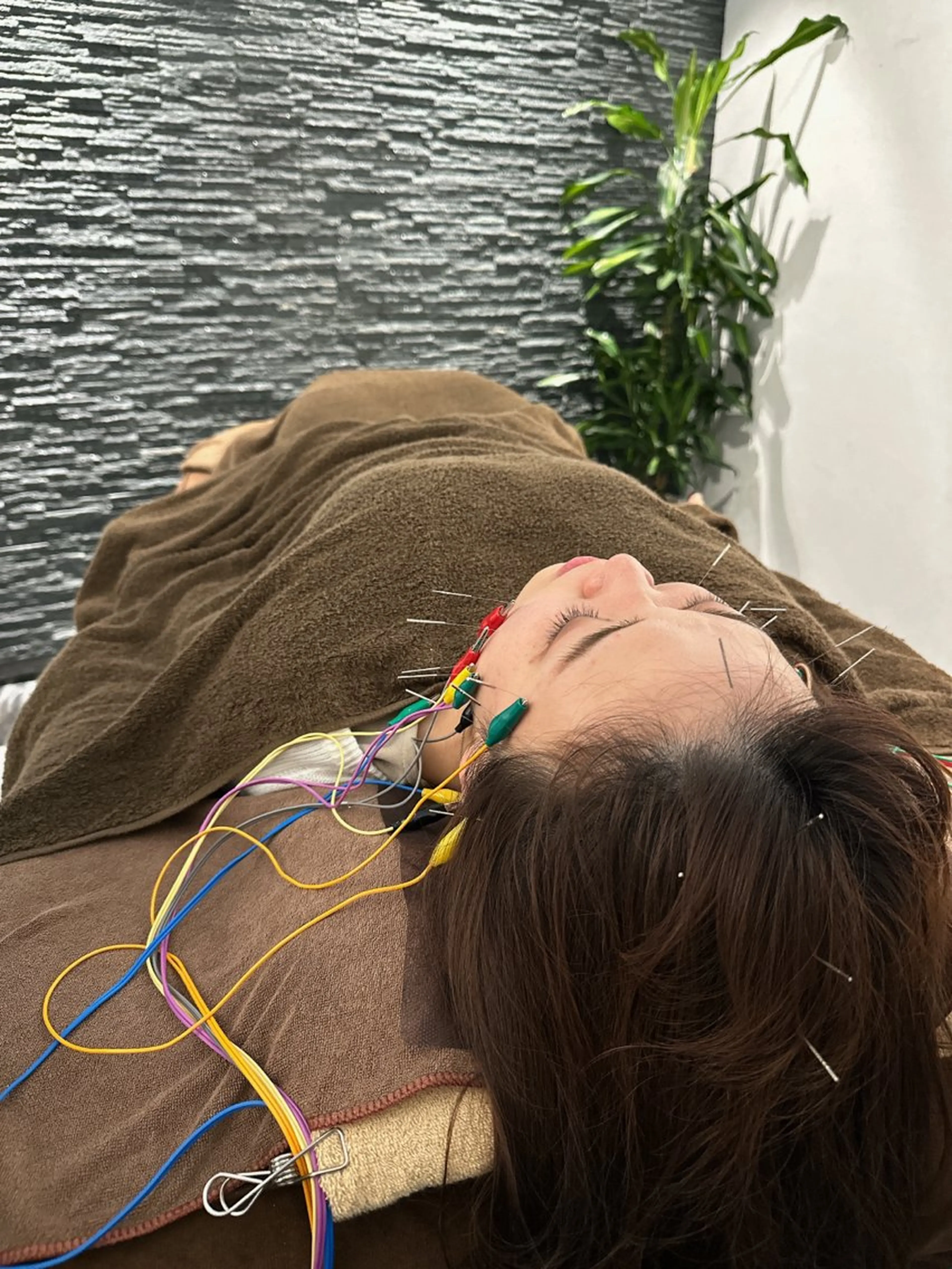 その他 美容鍼灸整体サロンBeauJu所属・小顔/美容鍼専門 BeauJuのその他イメージ