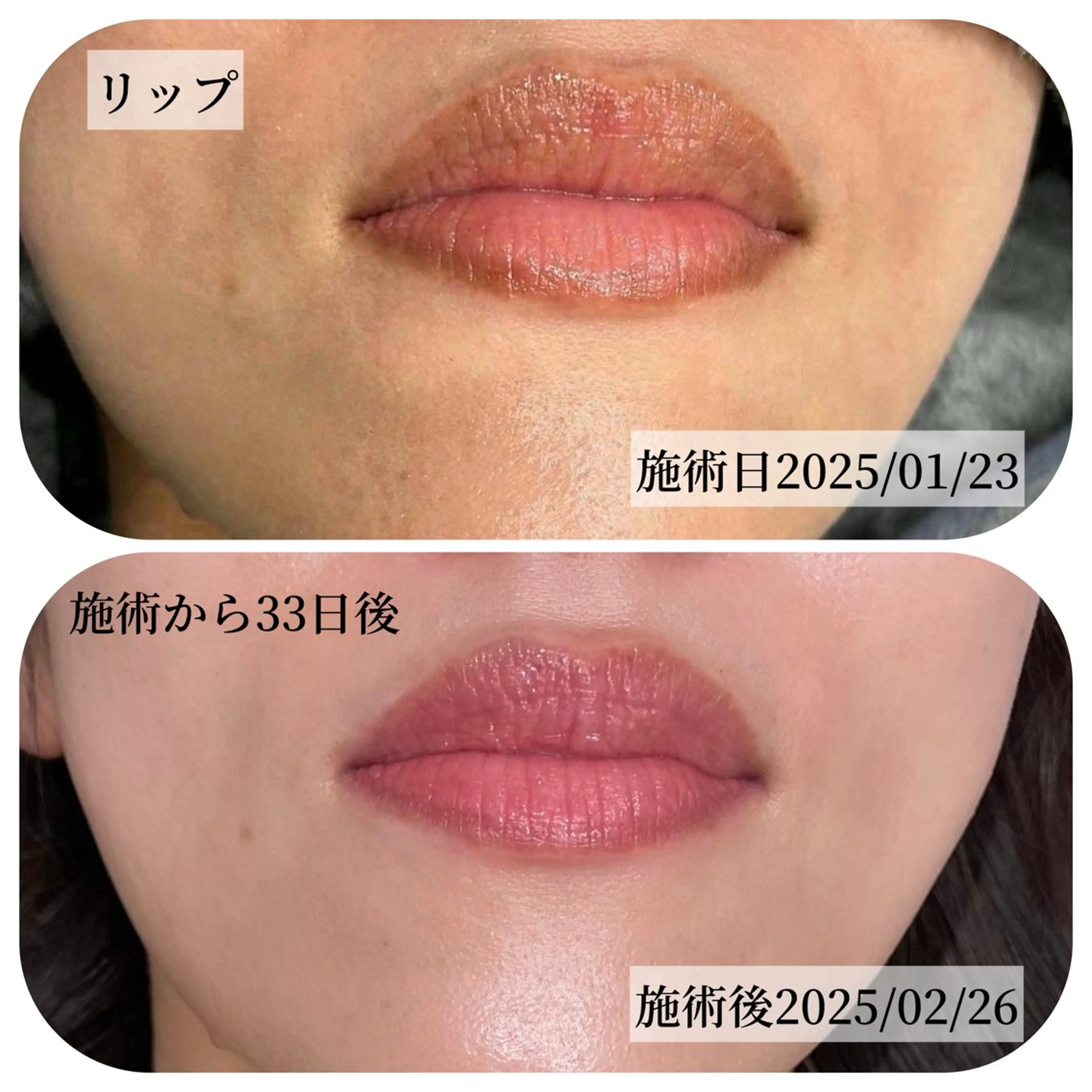 その他 Salon ALLIUM 恵比寿のエステ・リラクイメージ