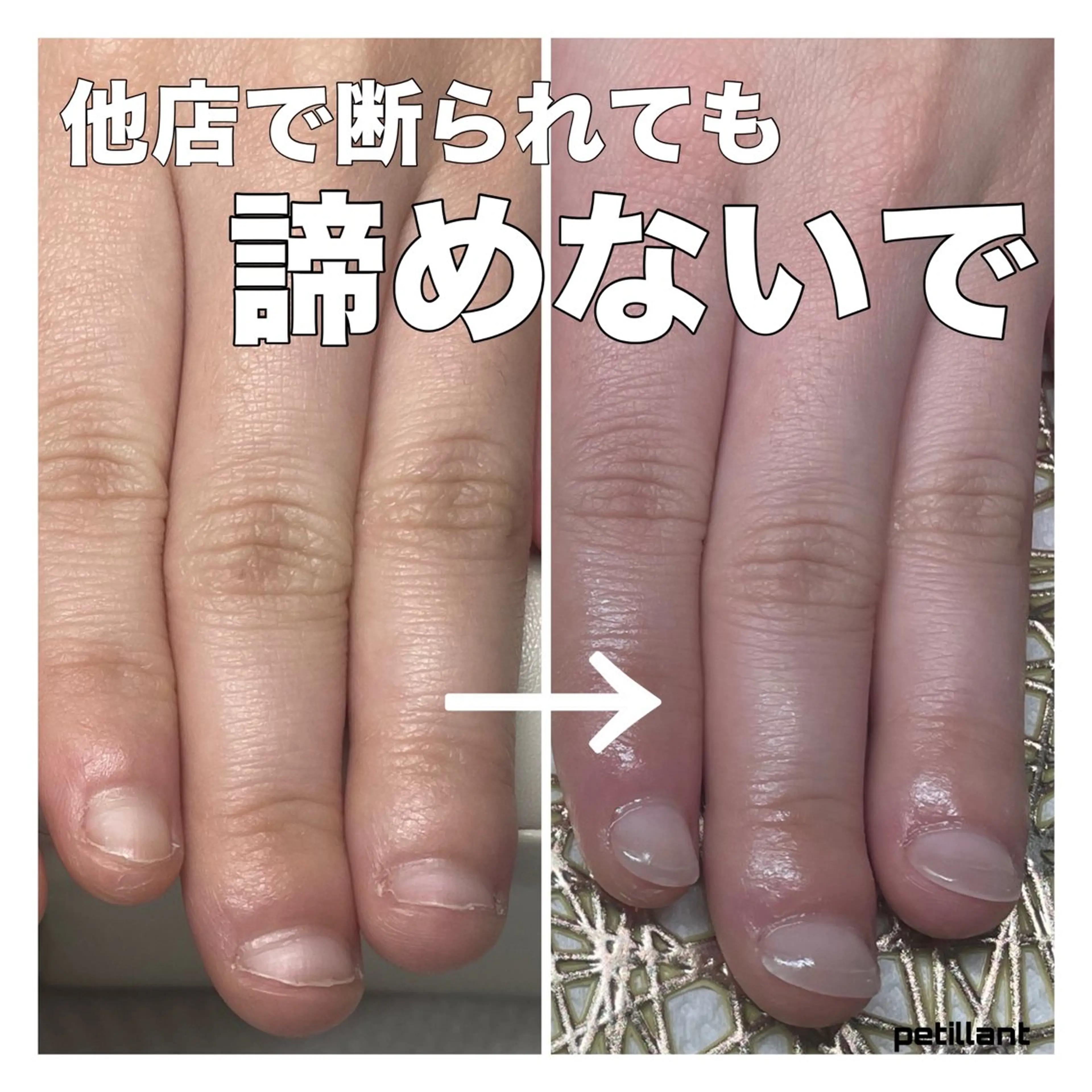 ネイル 長さ出し ハンドネイル ハンドケア petillant所属・nail salon petillantのネイルデザイン