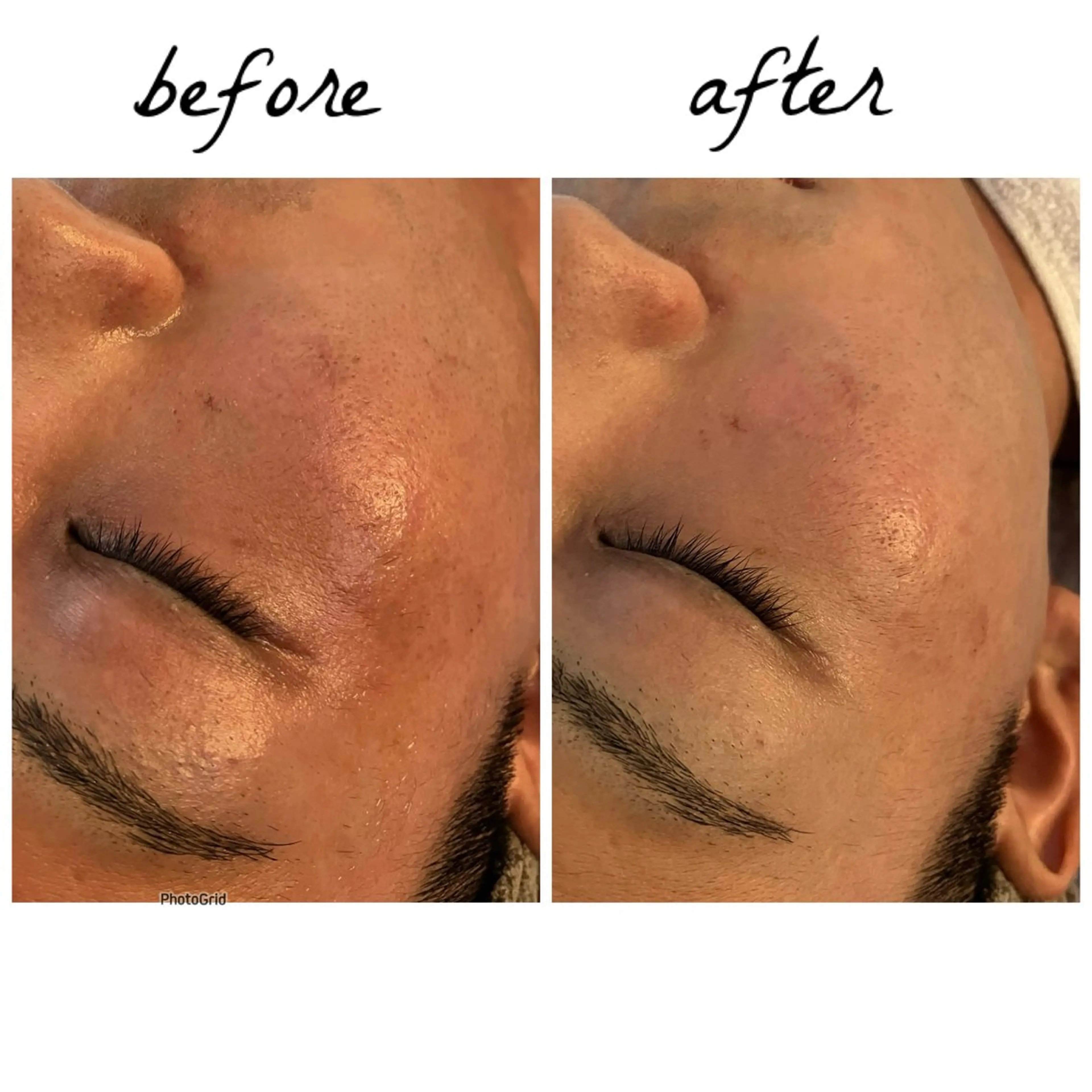 メンズ メナード岐阜茜部 杉浦のエステ・リラクイメージ