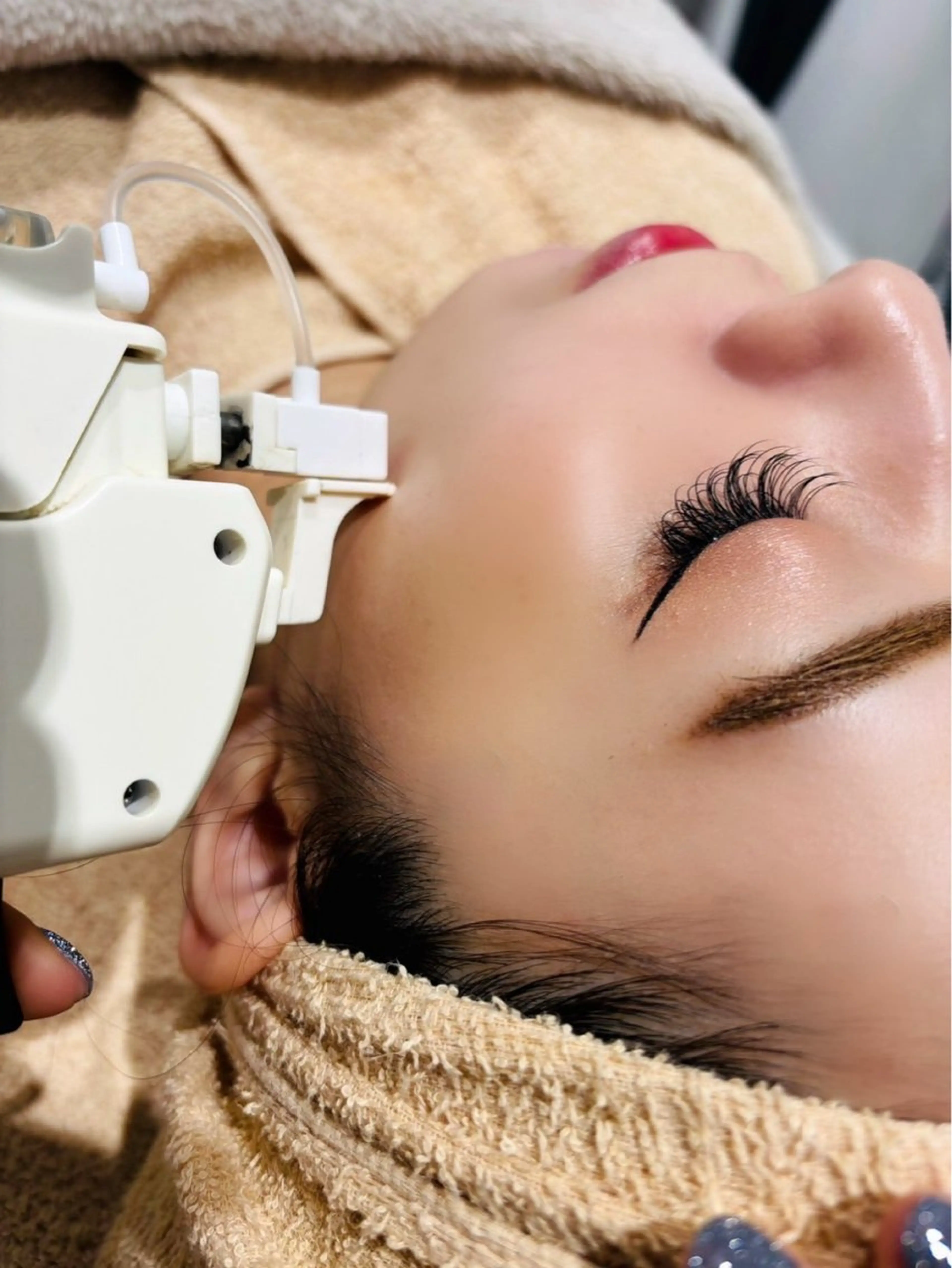 【限定！】エステ版ポテンツァ全顔フルコース10回の写真