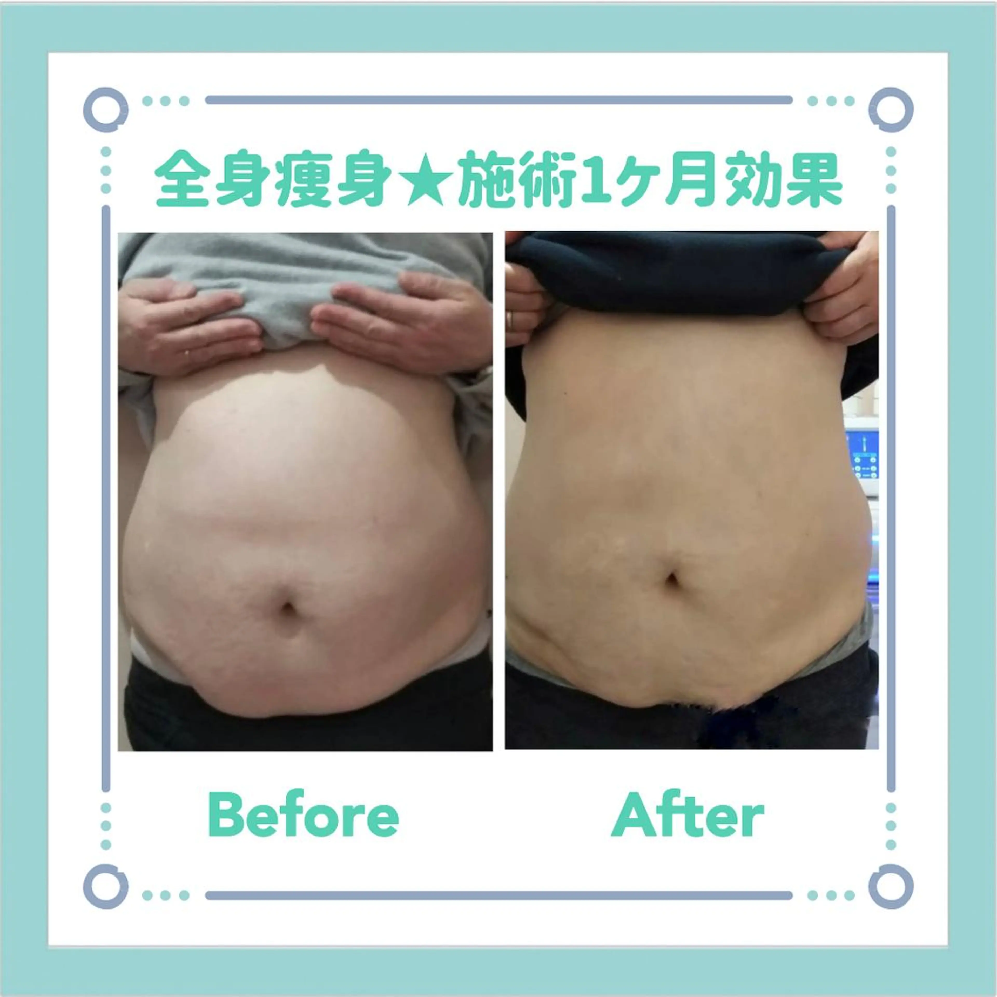 小顔痩身インディバ Nana表参道のエステ・リラクイメージ