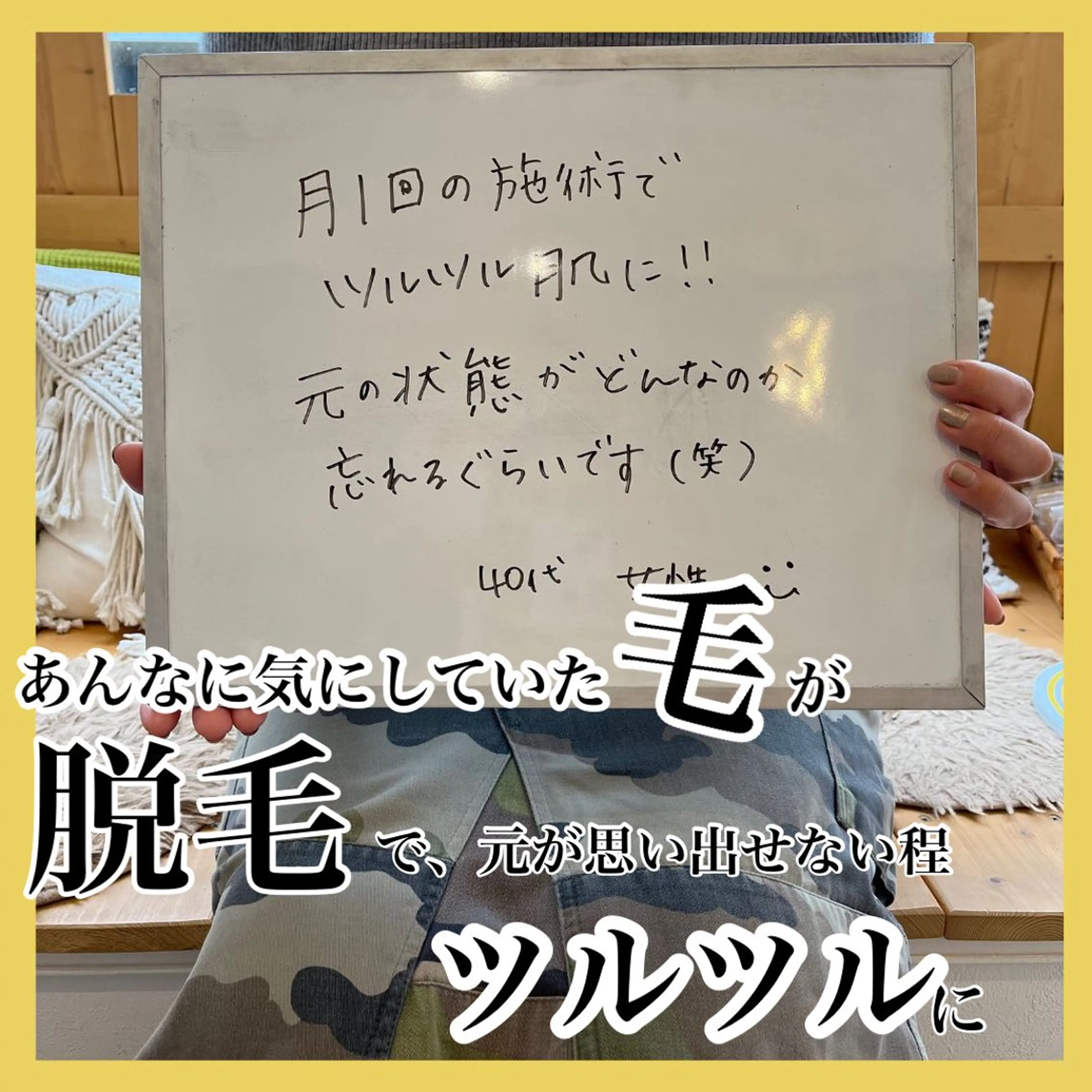 キッズ 脱毛 epismoo 脱毛/HBL/毛穴のエステ・リラクイメージ
