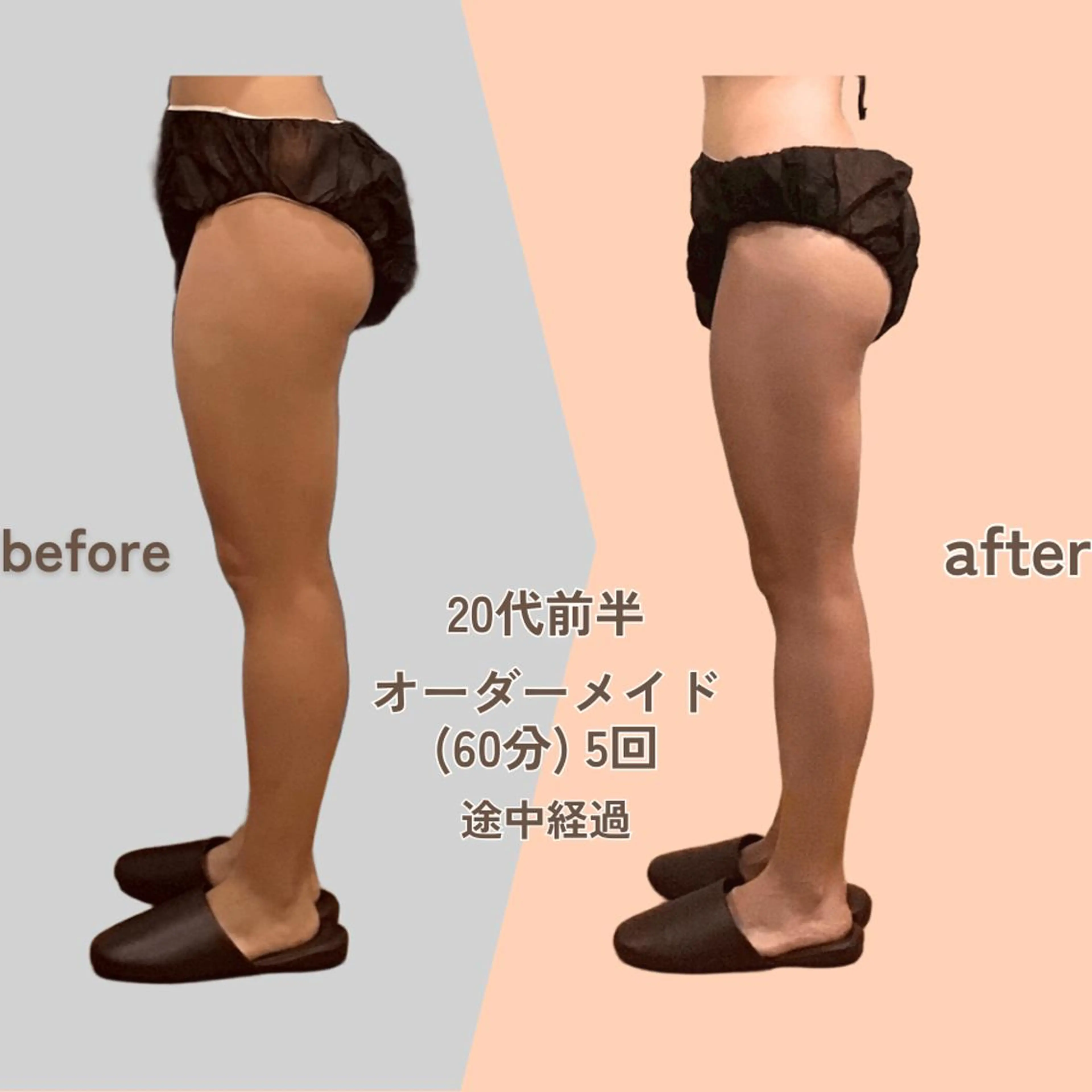 痩身エステ Julien麹町店のエステ・リラクイメージ