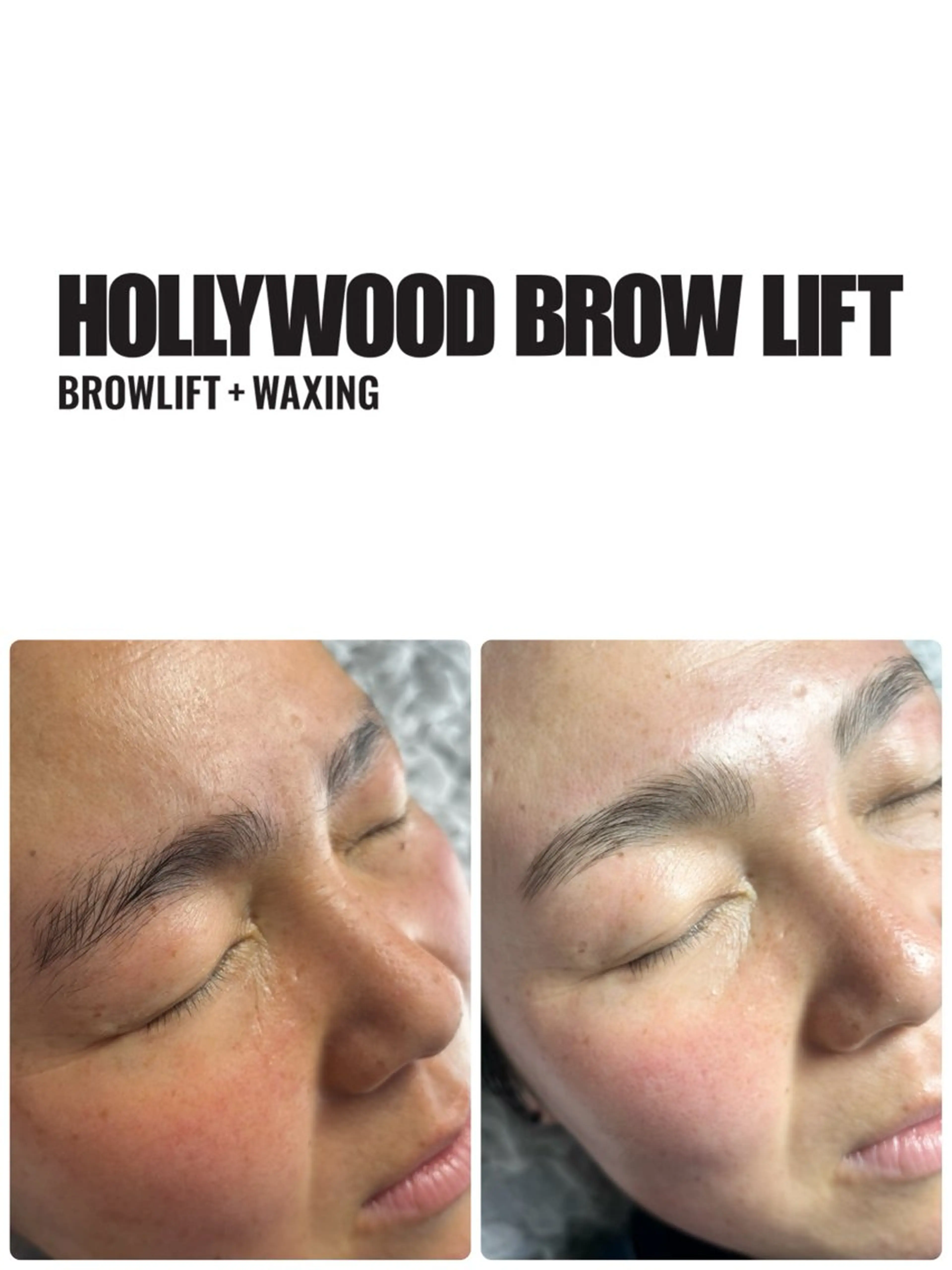 脱毛 MIKA ♡のネイルデザイン