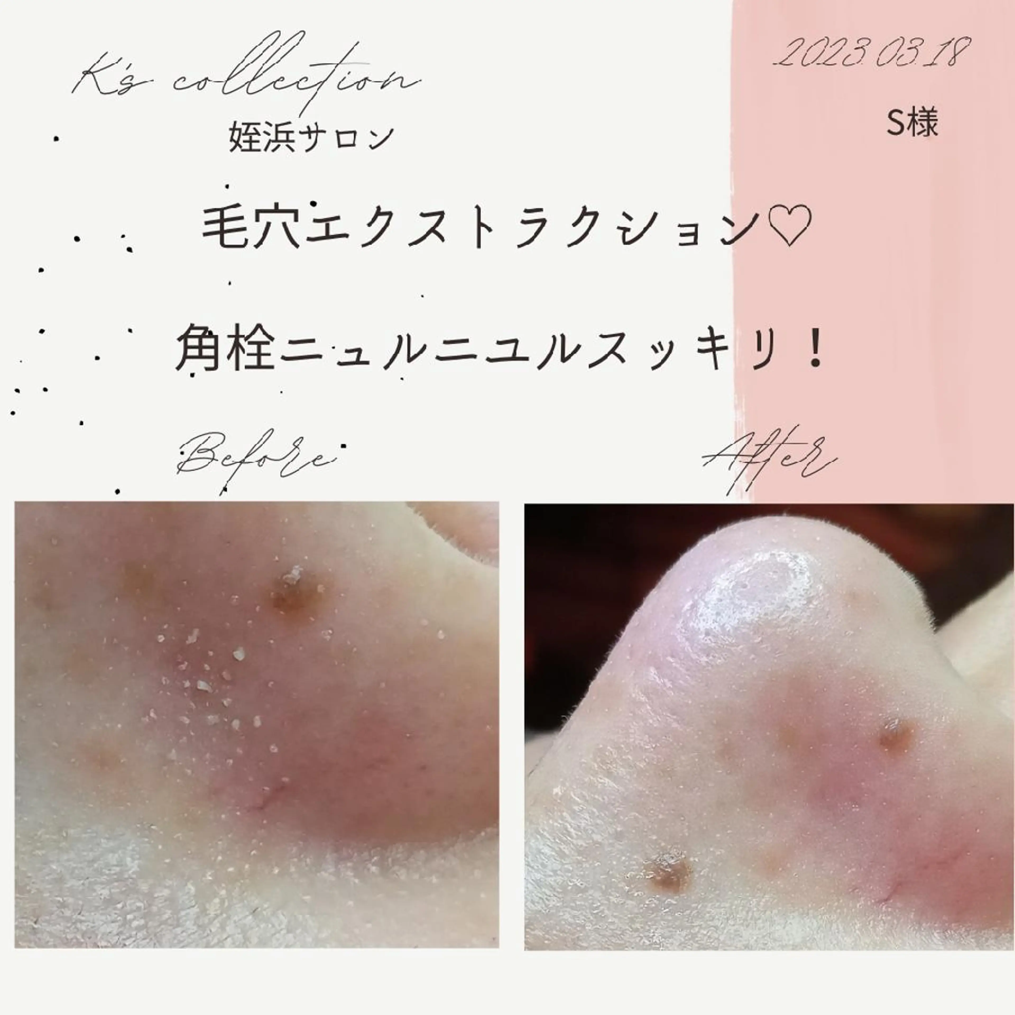 エステ K's姪浜エステ💆 サロン:MAIKOのエステ・リラクイメージ