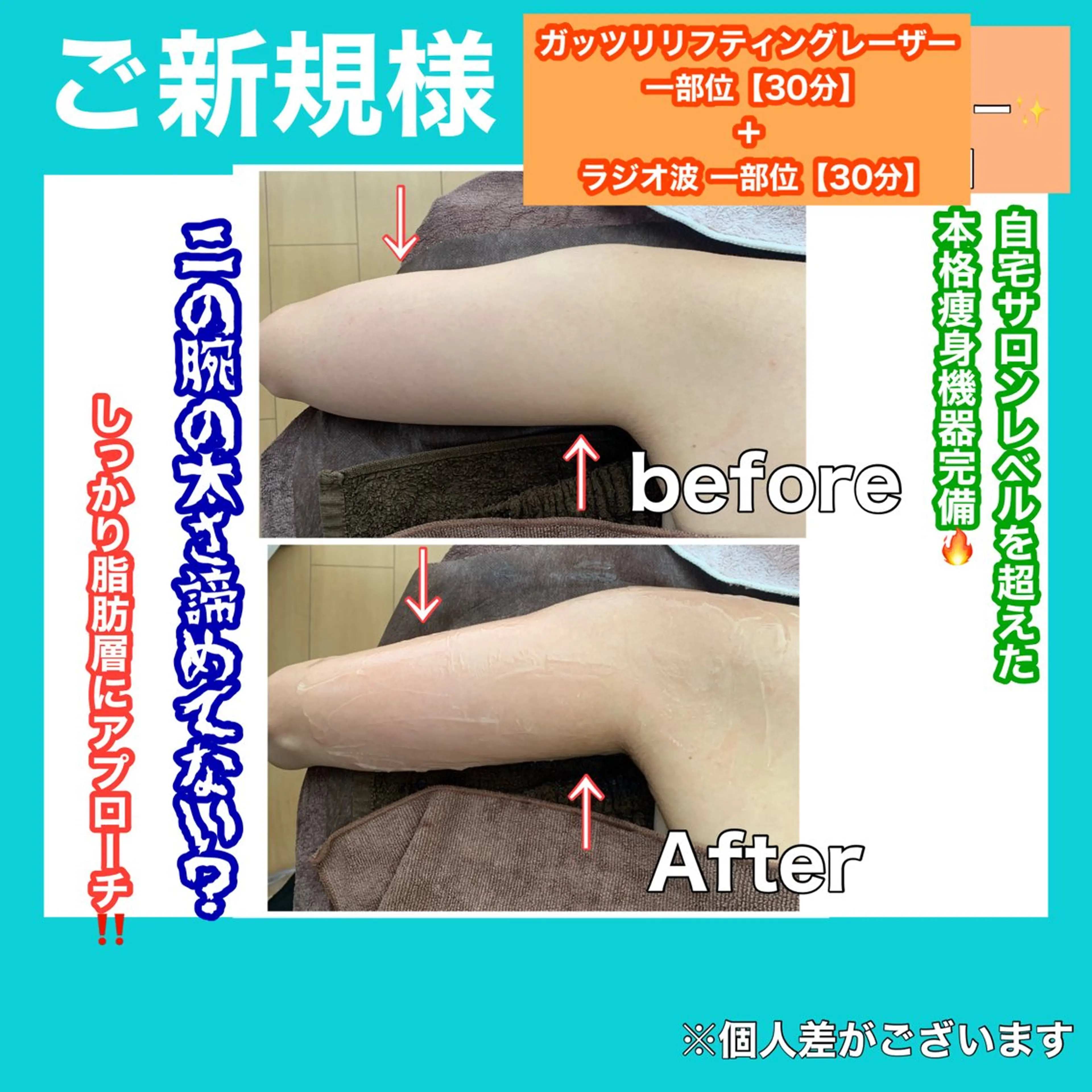 痩身/脱毛/ネイル HARUKAのエステ・リラクイメージ