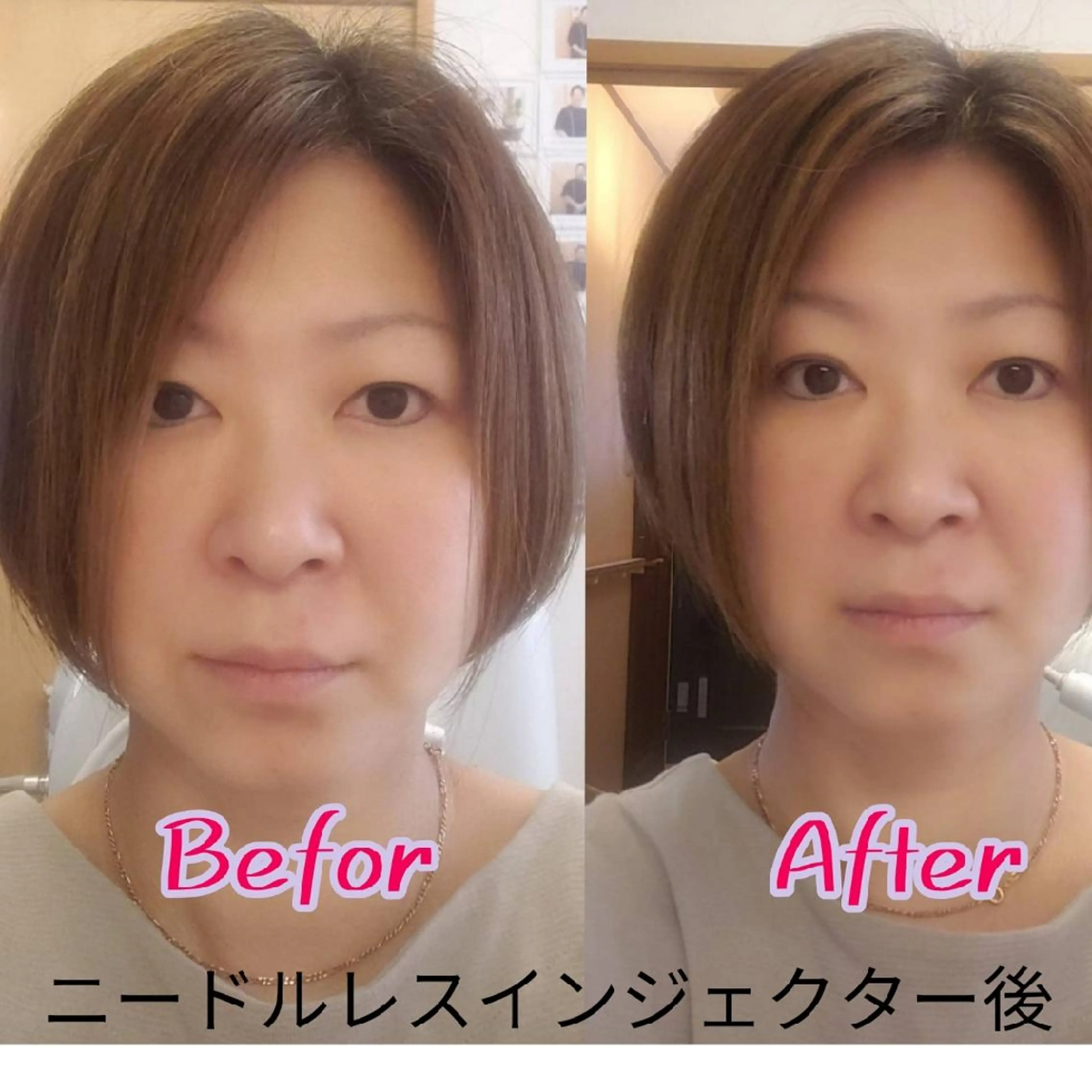 北梅田美容鍼灸院所属・美容鍼マイスター 川村　淳のエステ・リラクイメージ