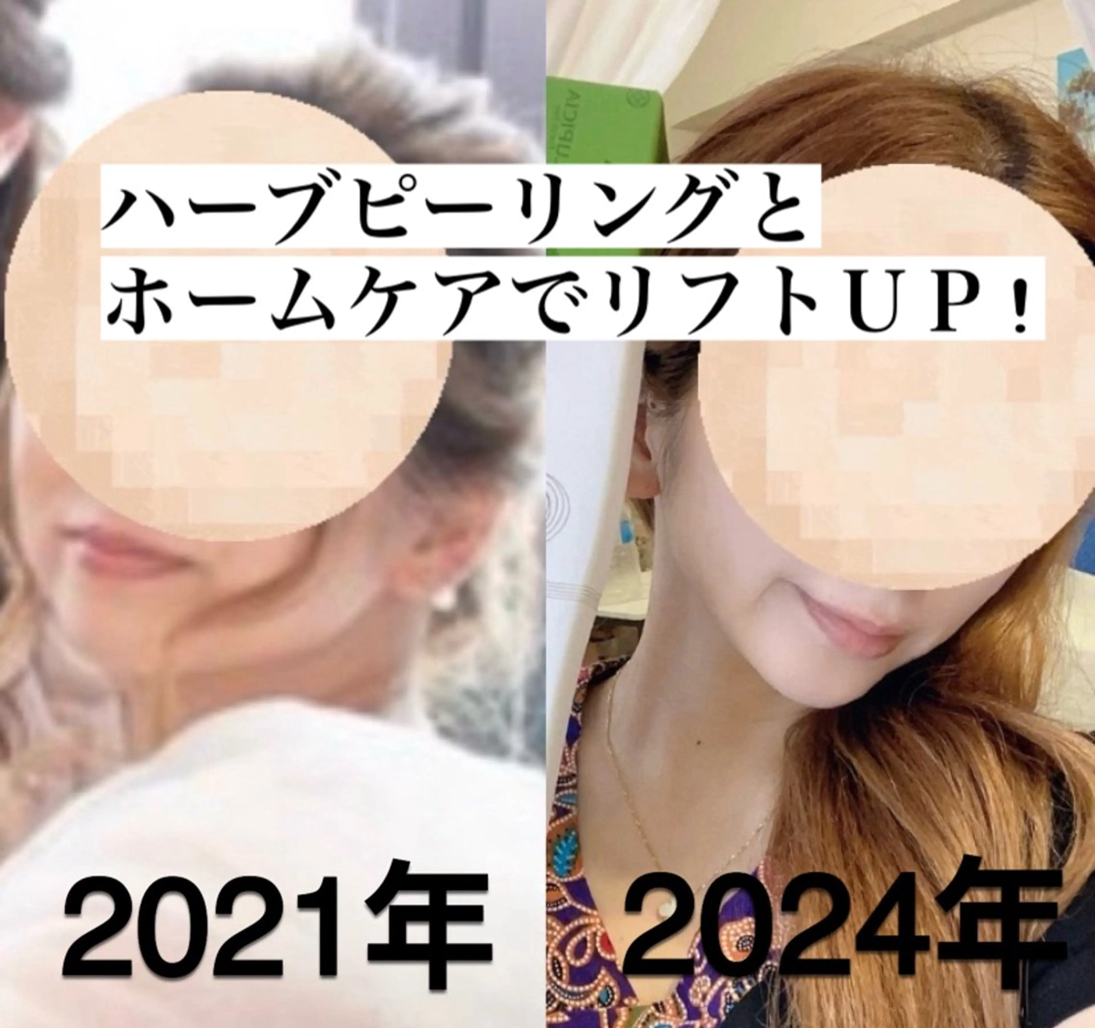 エステ クレアス勝どき・肌質改善専門店【CREAS Beauty Salon】所属・クレアス勝どき【毛穴 ハーブピーリング専門のエステ・リラクイメージ