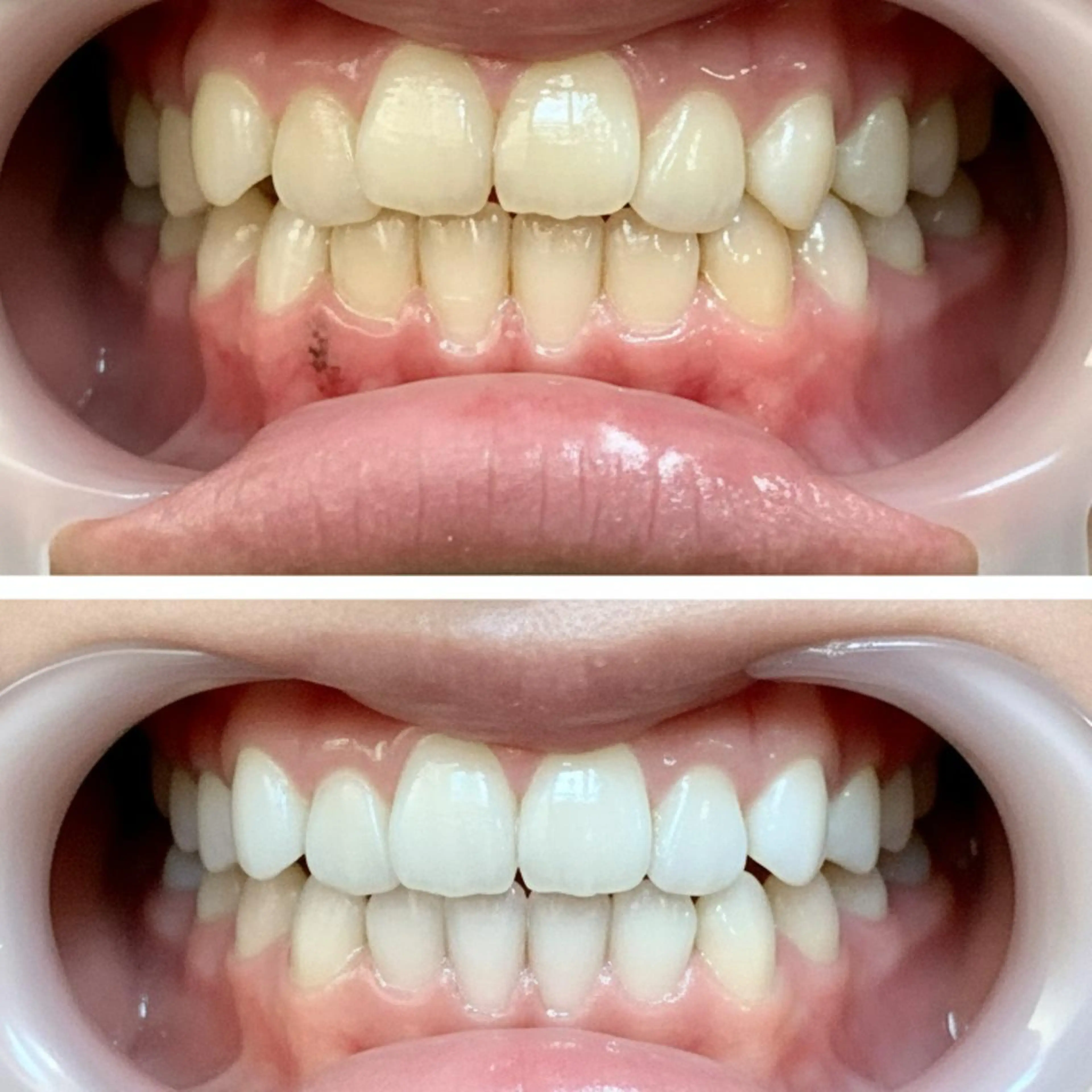 ホワイトニングサロン ダンブランシュサンダのエステ・リラクイメージ