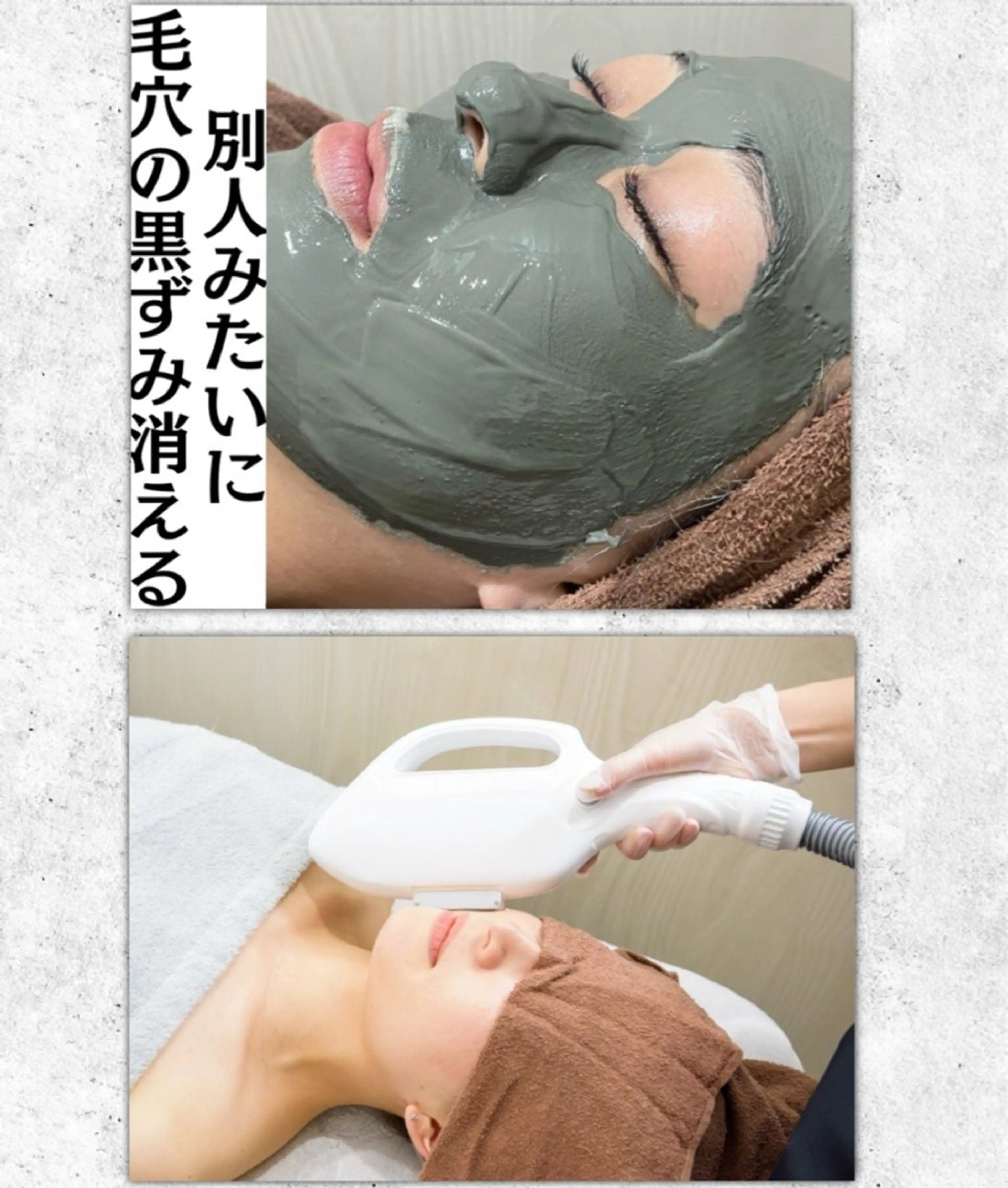 平日　13時​〜​16時まで限定　　　　　　　　　　　　【全顔毛穴洗浄】✖️【光フェイシャル】60分極上なご褒美ケアの写真