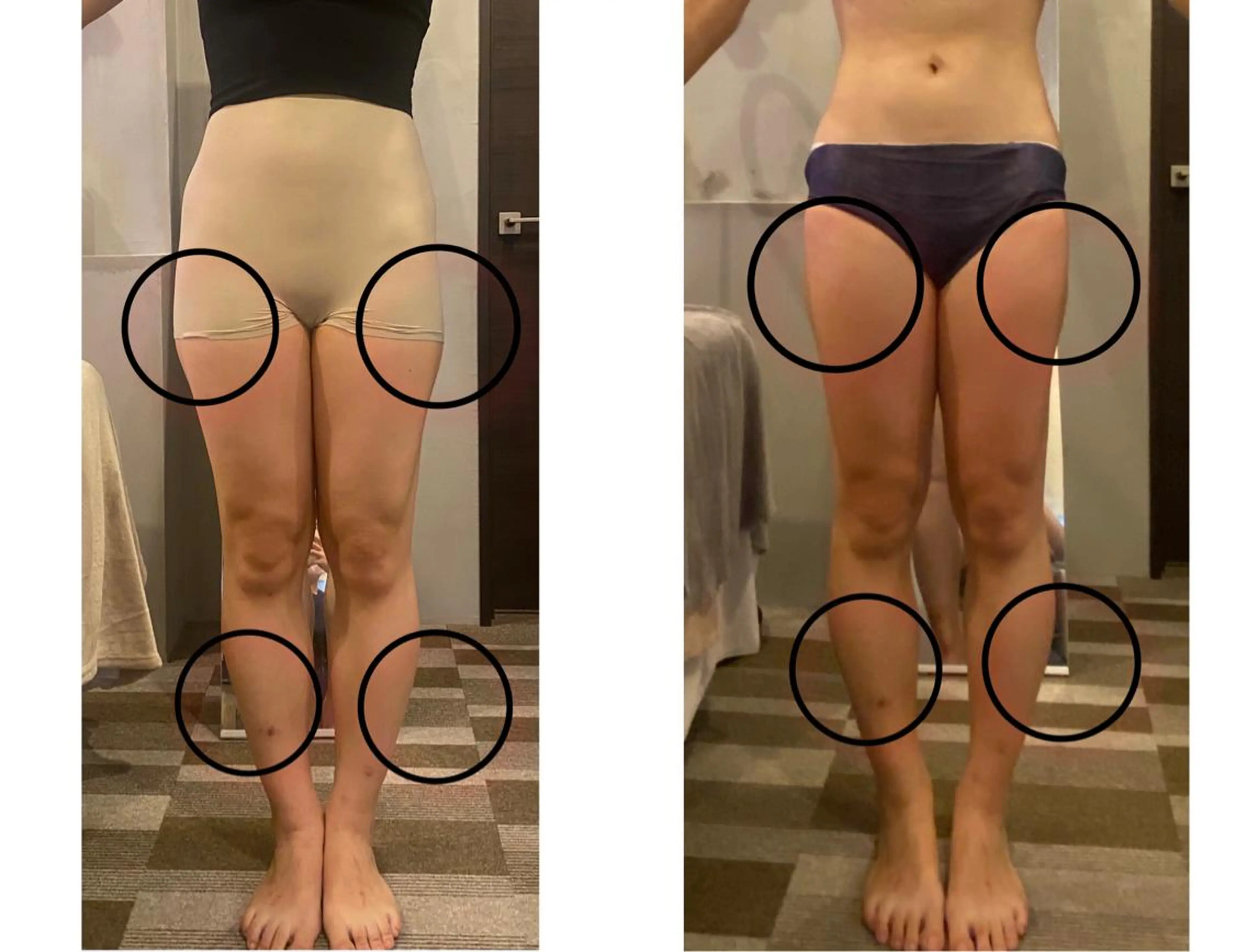 TEIKOKU所属・トータルビューティー TEIKOKUのエステ・リラクイメージ