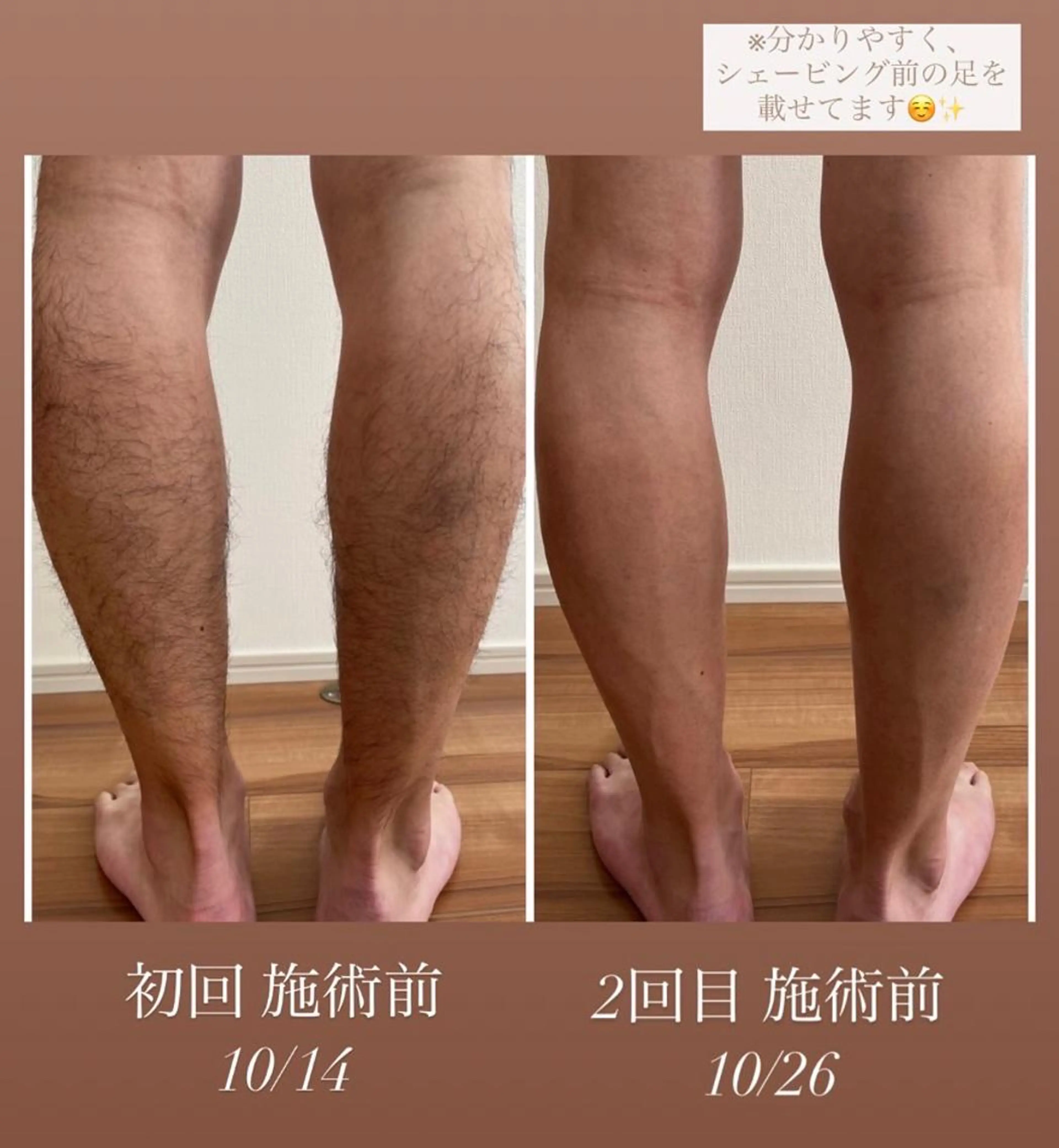 脱毛 エステサロン Mi-mi.iのエステ・リラクイメージ