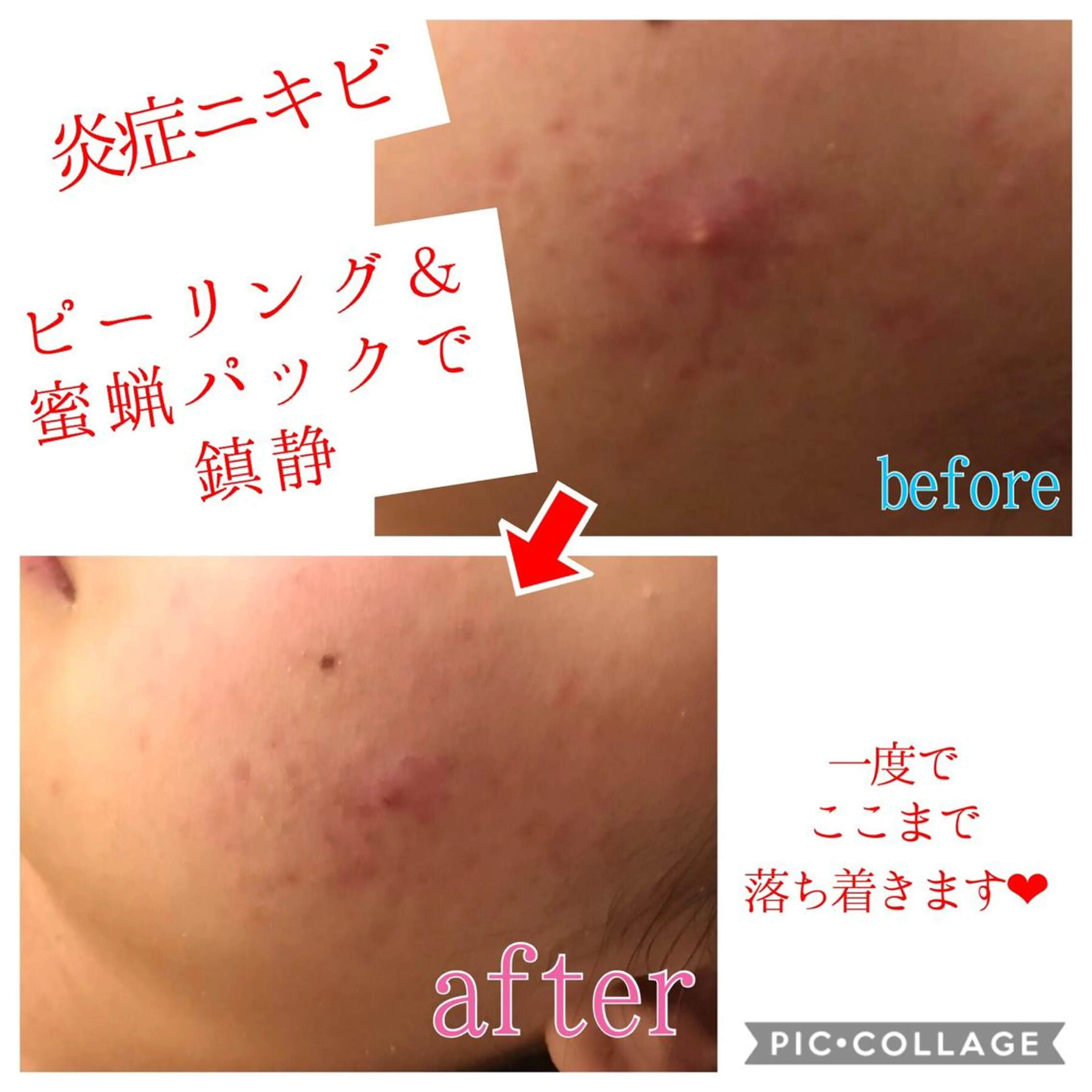 セミロング カラー パーマ ヘアアレンジ メンズ キッズ ネイル マツエク・マツパ 四つ星サロン🎖 腸＆ニキビケアに特化のエステ・リラクイメージ
