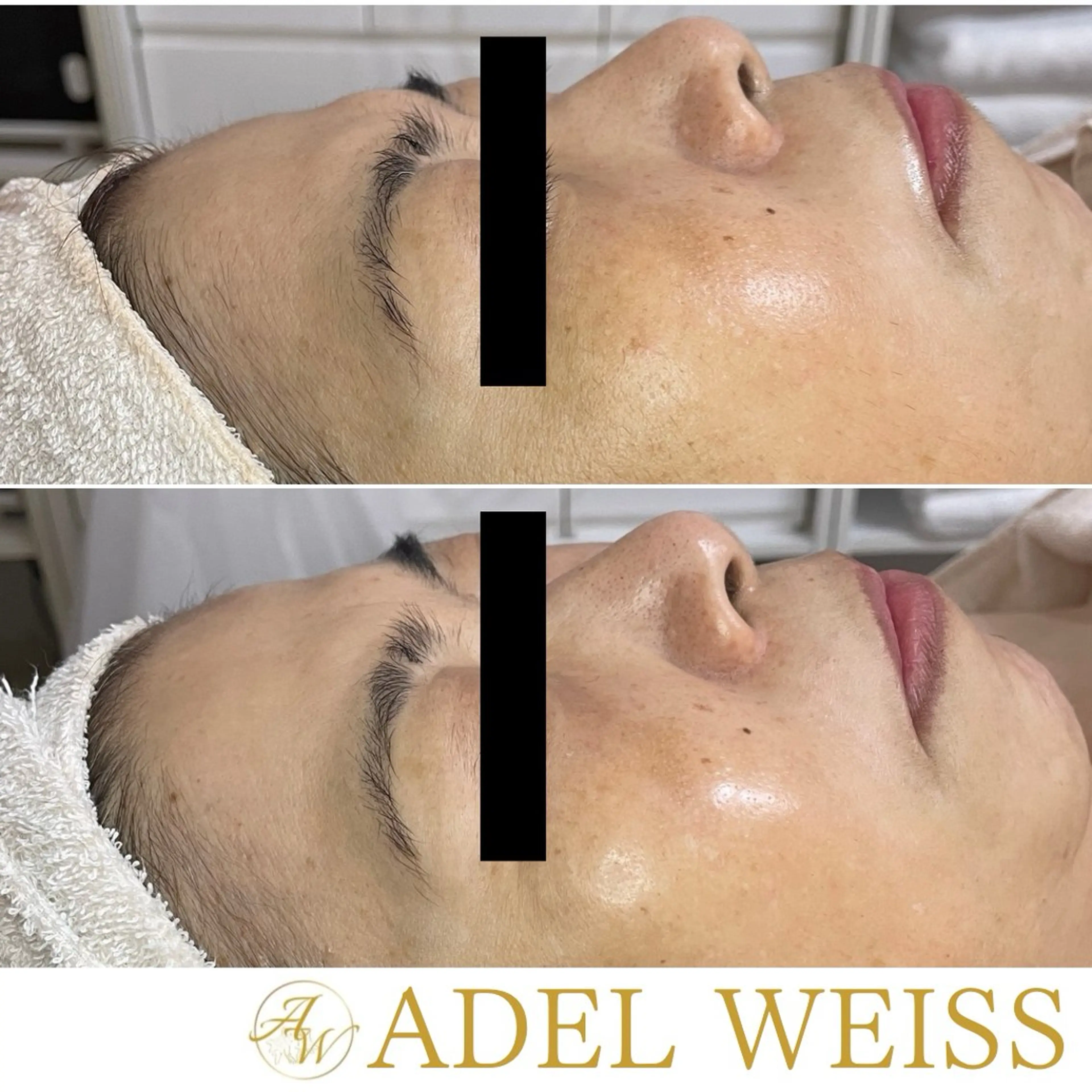 エステ 毛穴ケア＆脱毛サロン　ADEL WEISS所属・毛穴ケア＆脱毛サロン ADEL　WEISSのエステ・リラクイメージ