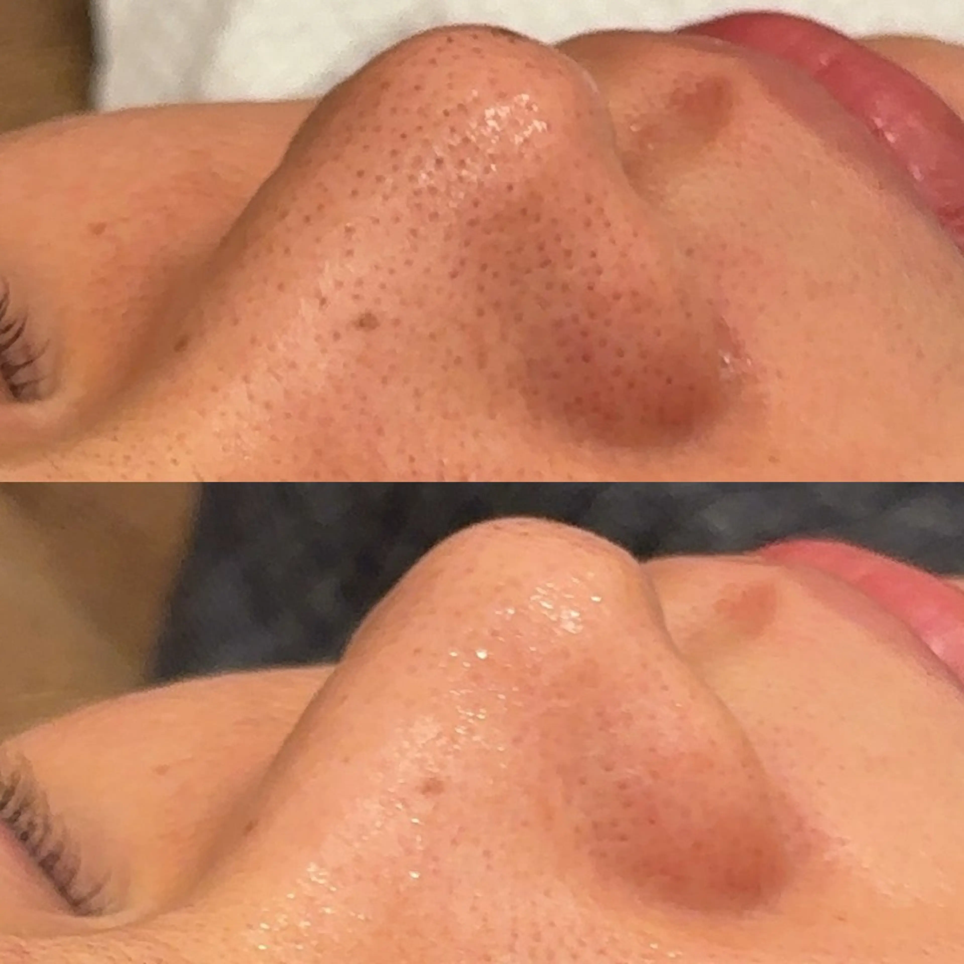 エステ リラク Hari Lounge恵比寿所属・chika🦋 ハリラウンジ恵比寿のエステ・リラクイメージ