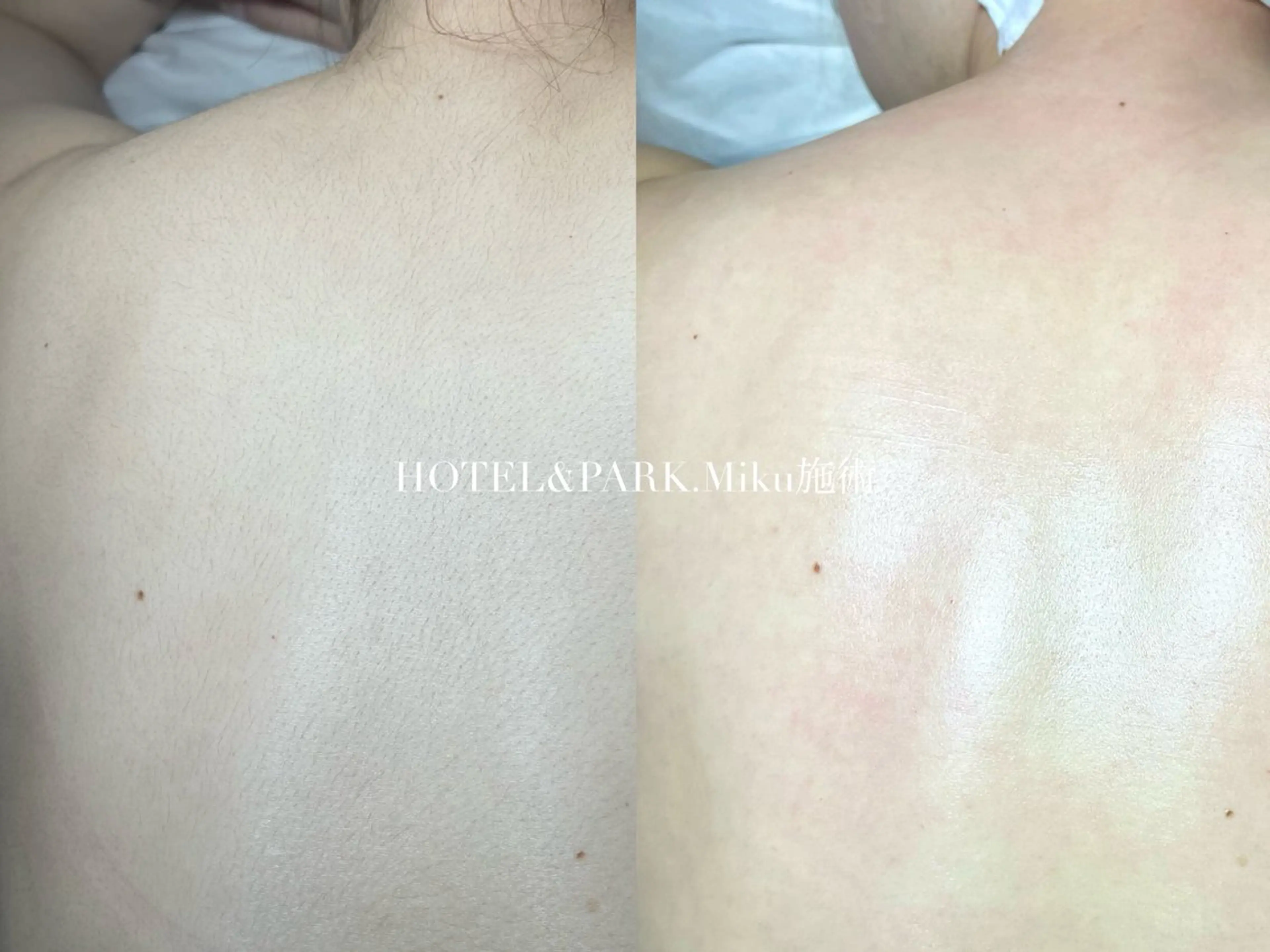 脱毛 HOTEL&PARK Mikuワックス脱毛のエステ・リラクイメージ