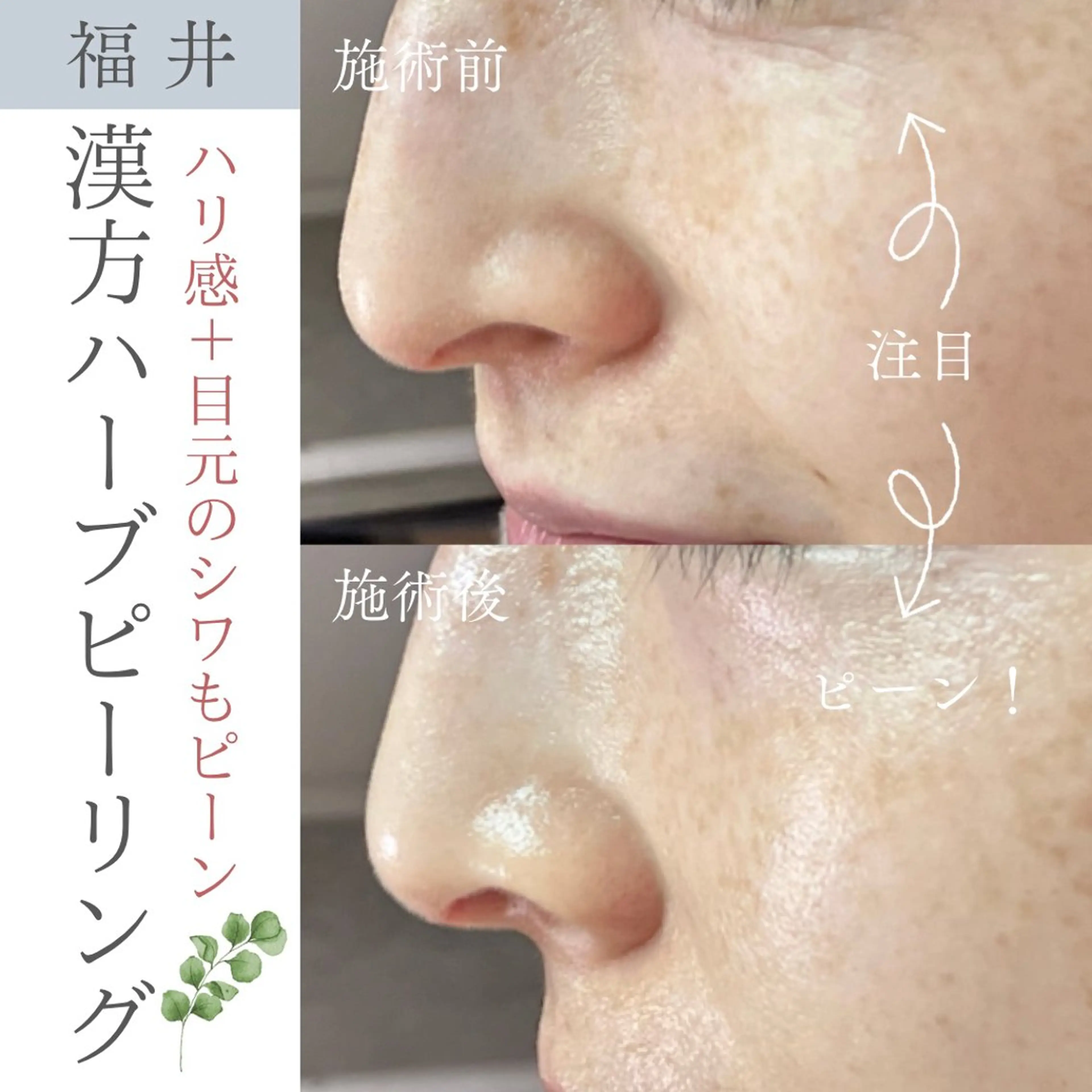 毛穴ケア専門サロン Yourmeユアミーのエステ・リラクイメージ