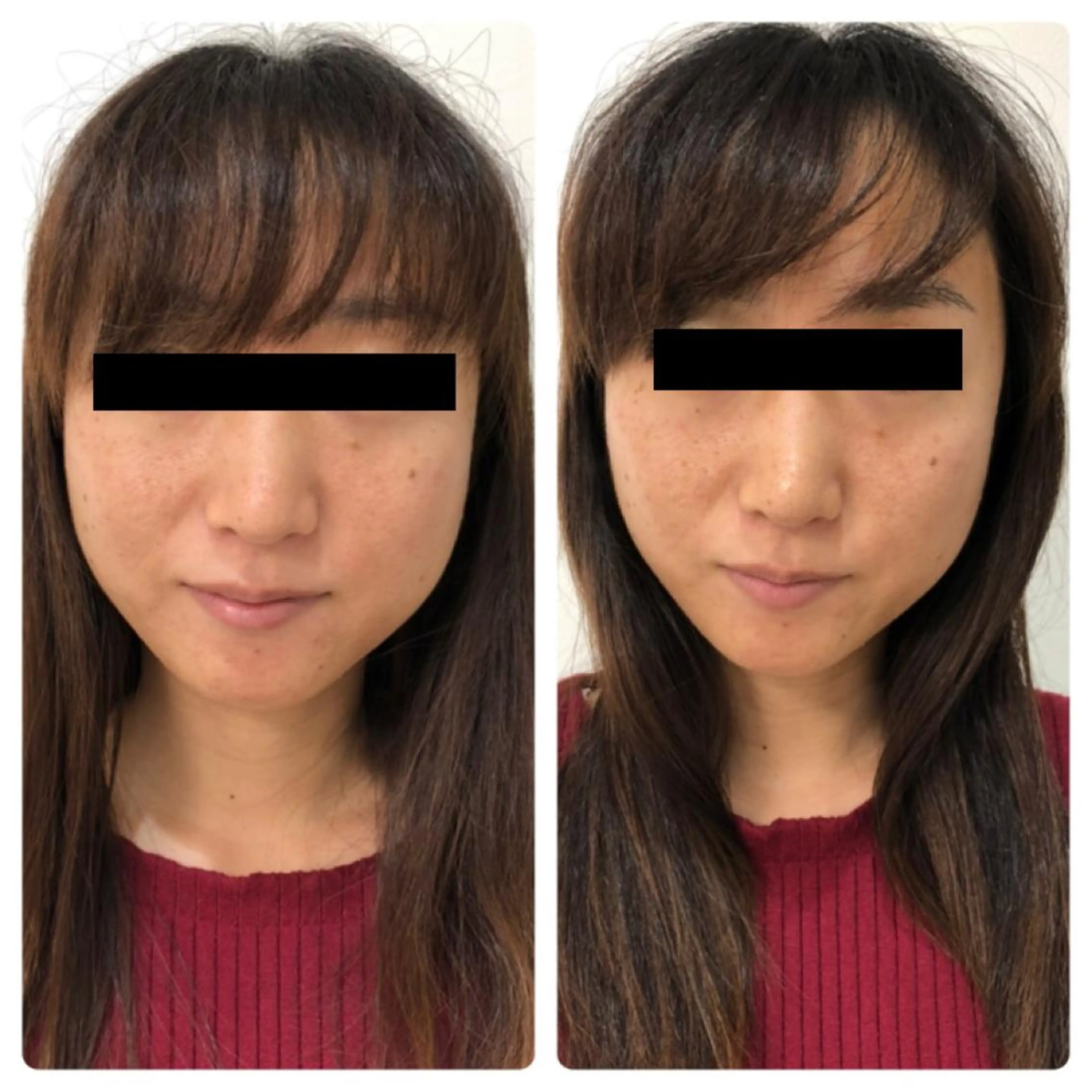 エステ BeautySalonGemmy所属・Gemmy 愛美のエステ・リラクイメージ