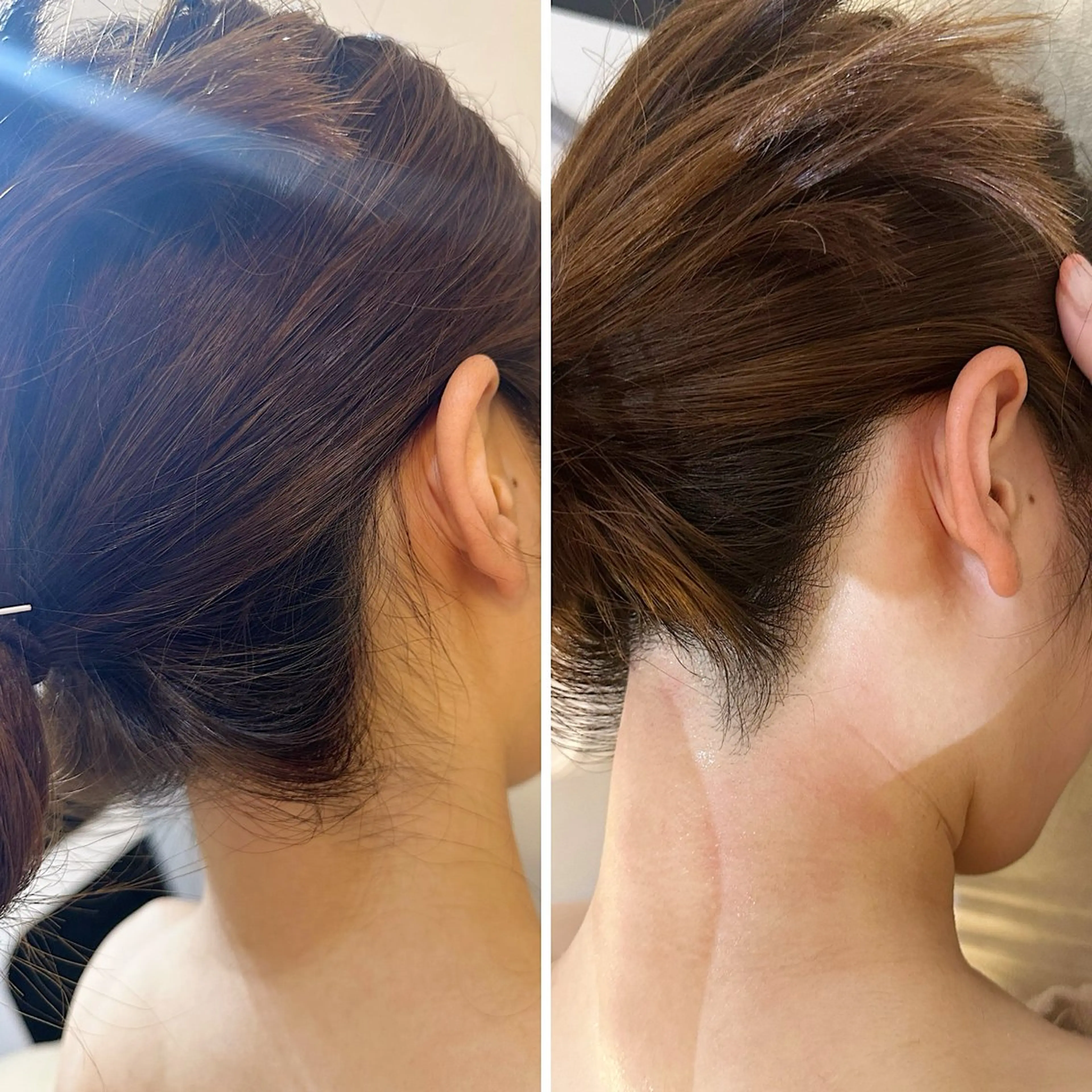 脱毛 うなじ脱毛/美肌脱毛 LABELのエステ・リラクイメージ