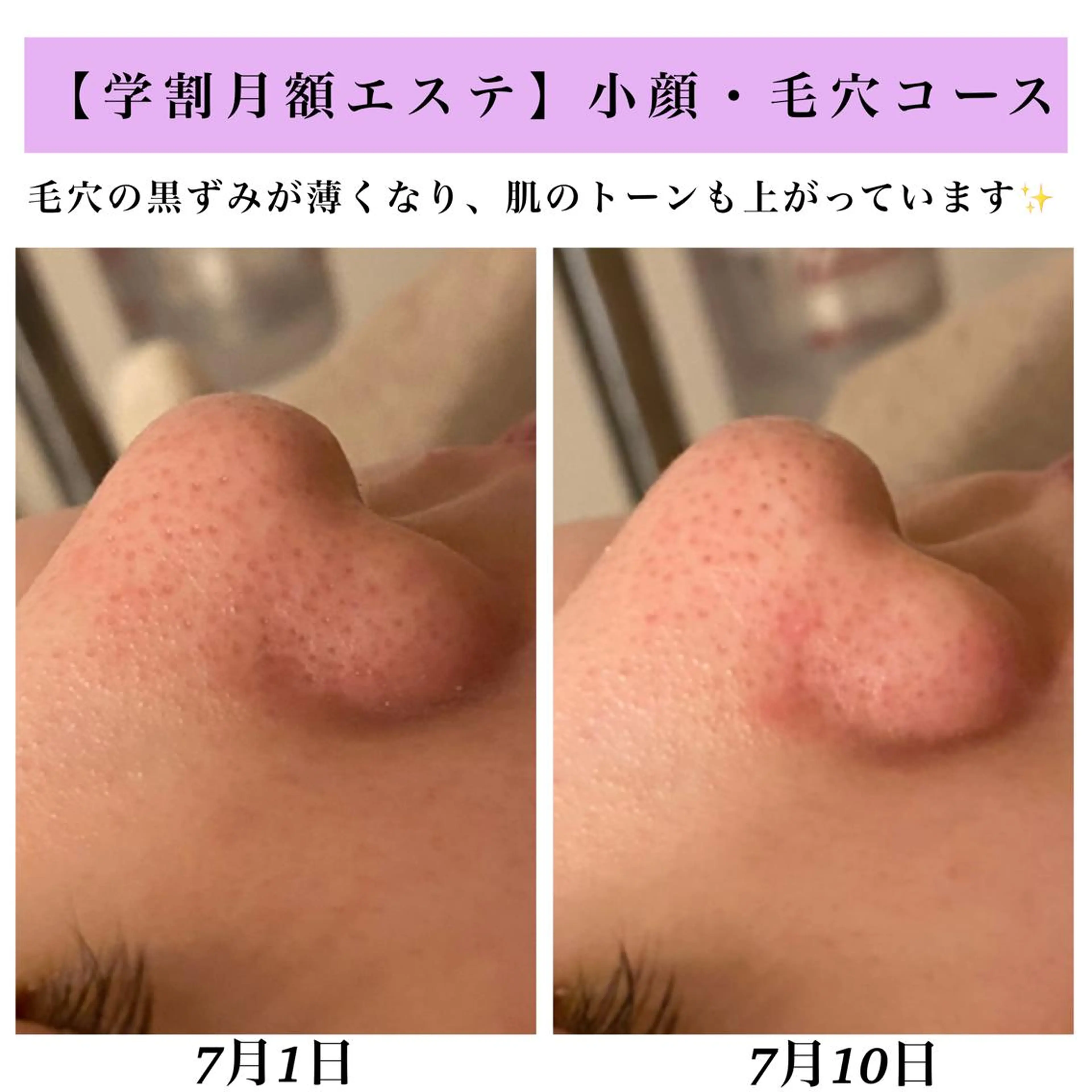 Bellesthe （ベルエステ）のエステ・リラクイメージ