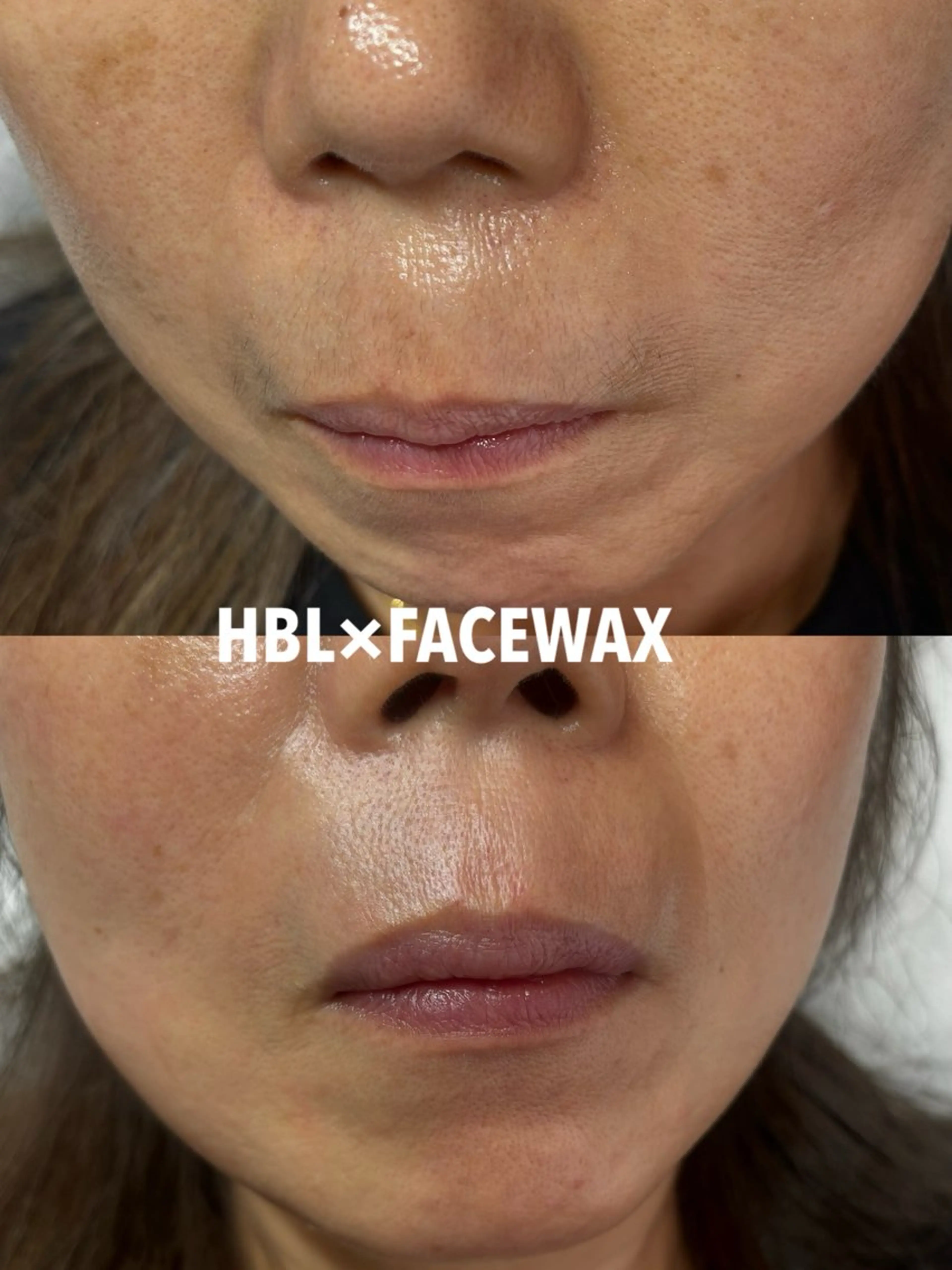 Sパーツワックス(おでこ、頬、鼻毛、口周り)この中から１箇所のみの写真