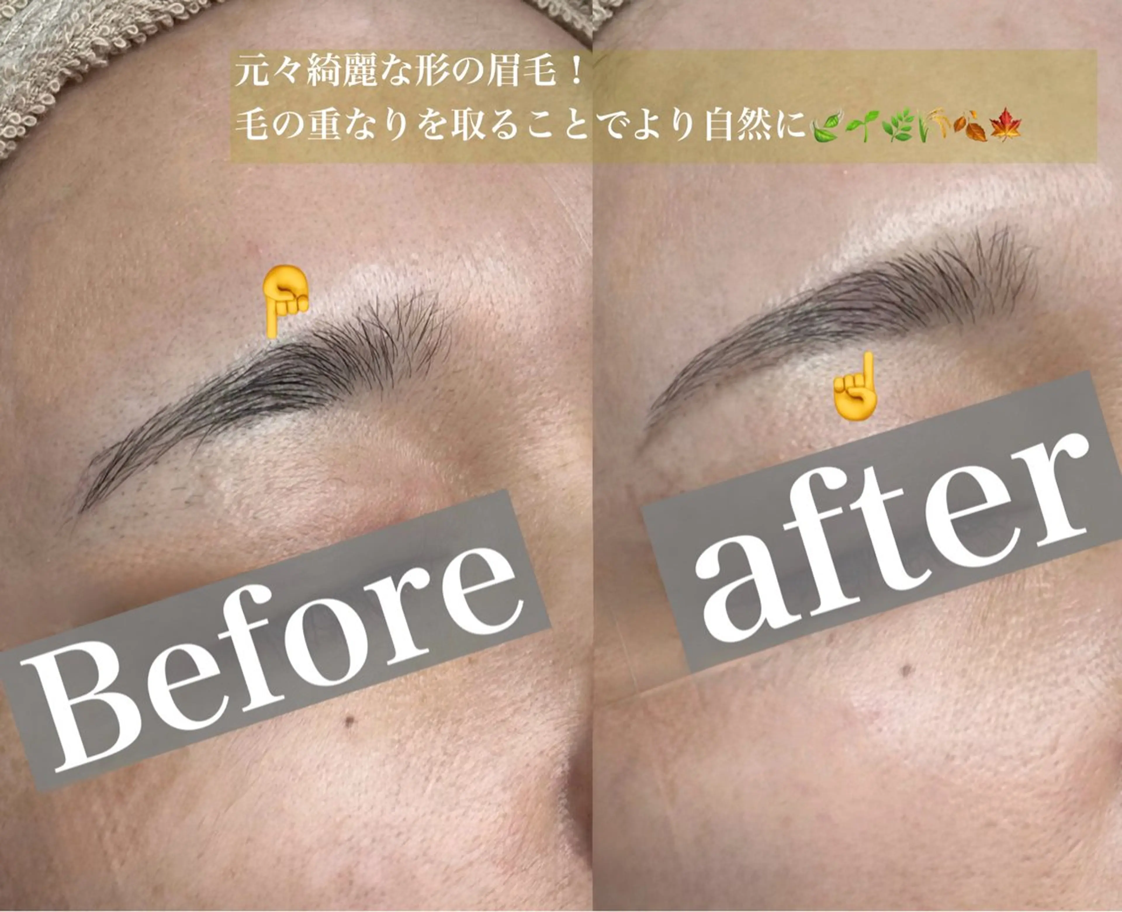 眉毛ワックス脱毛の写真