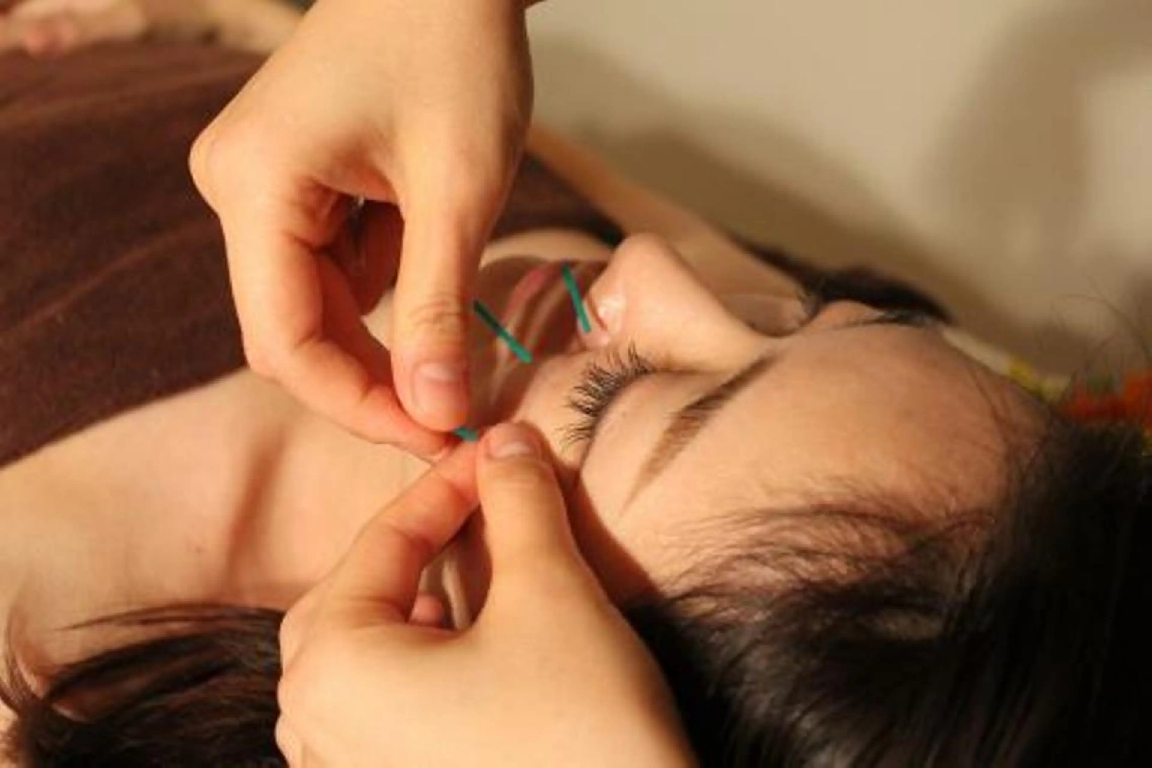 小顔矯正・美容鍼 美鍼堂のエステ・リラクイメージ