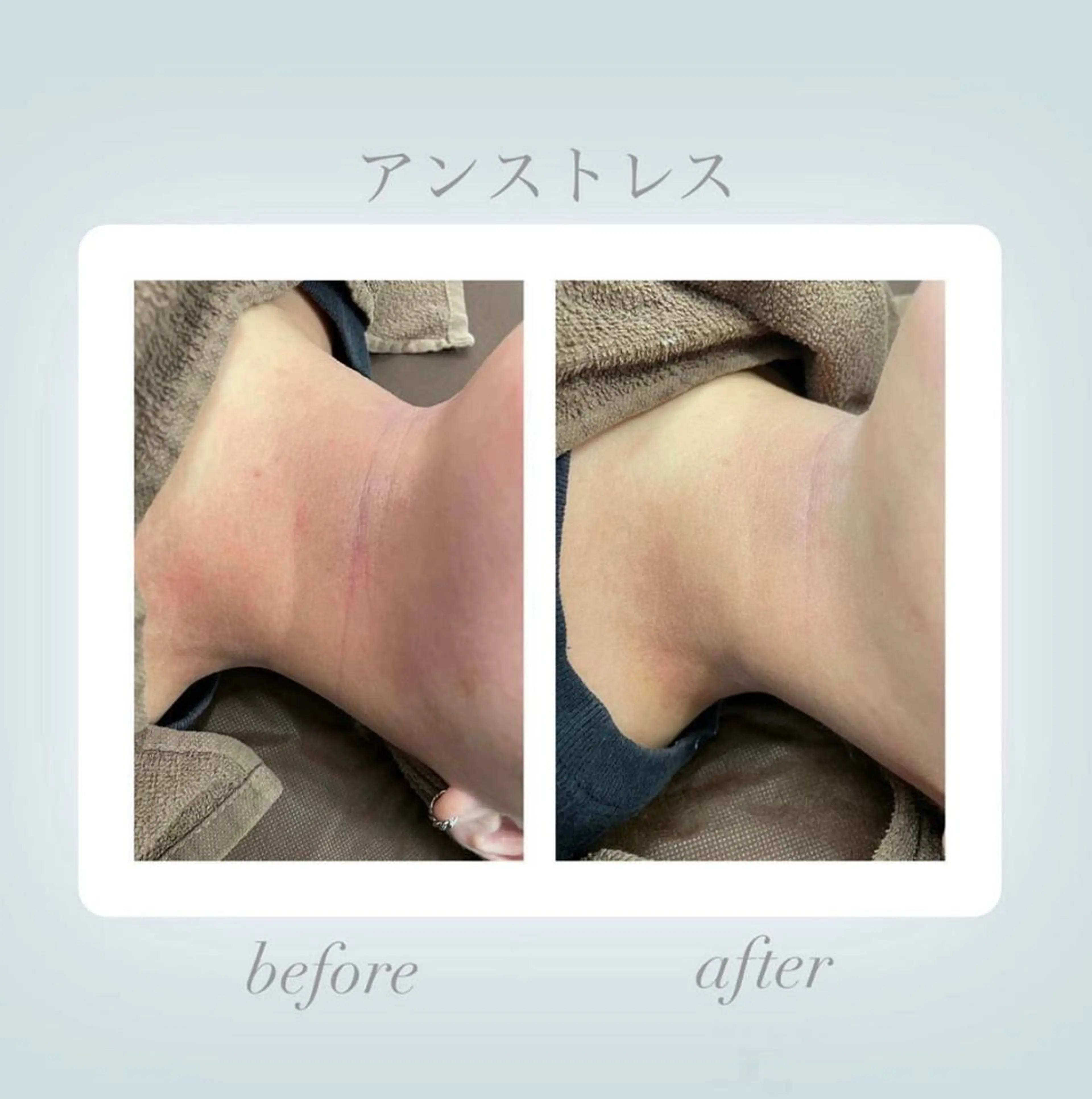 エステ 🦋美肌サロン. maho🦋のエステ・リラクイメージ