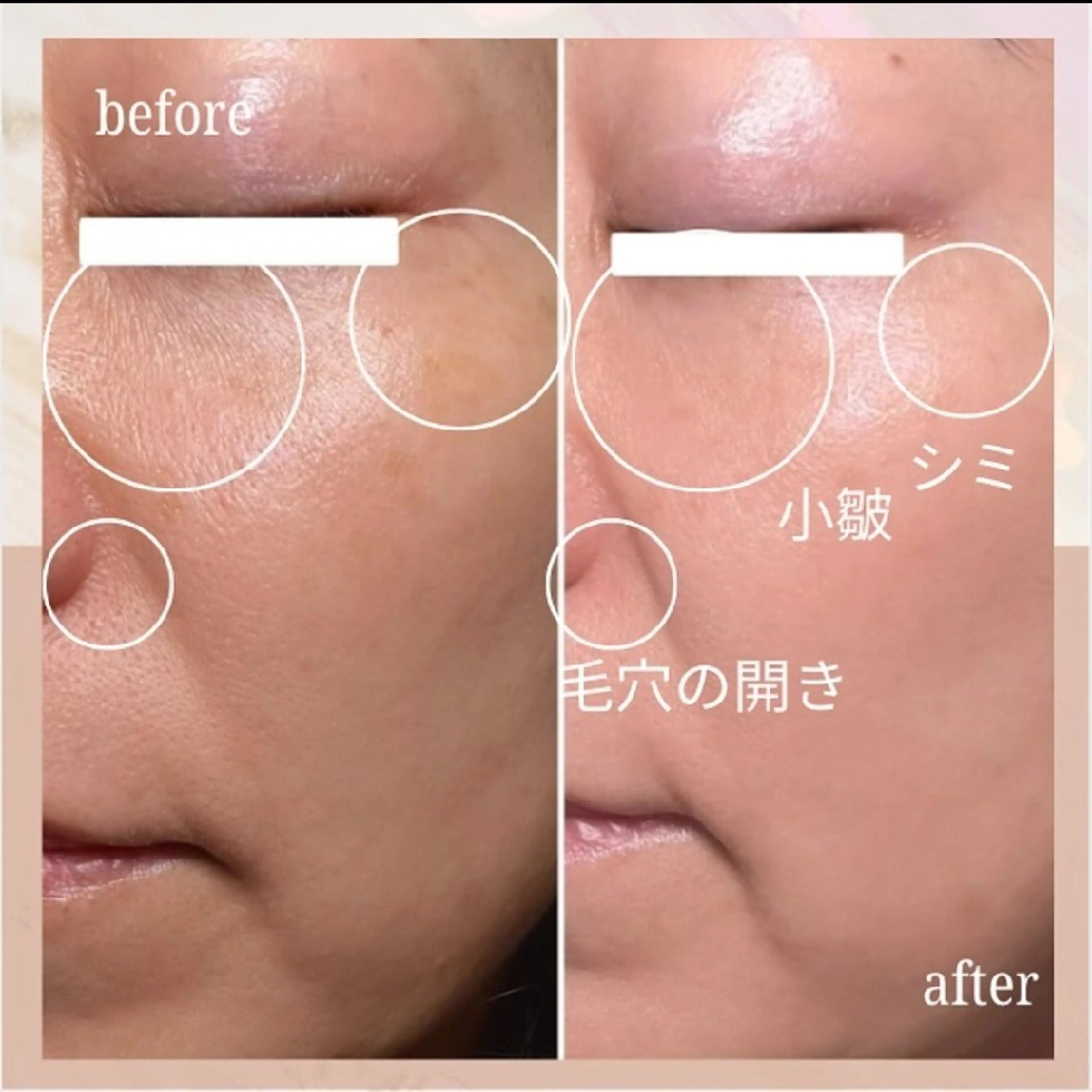 ナスサロ️ 看護師️🫧山口のエステ・リラクイメージ