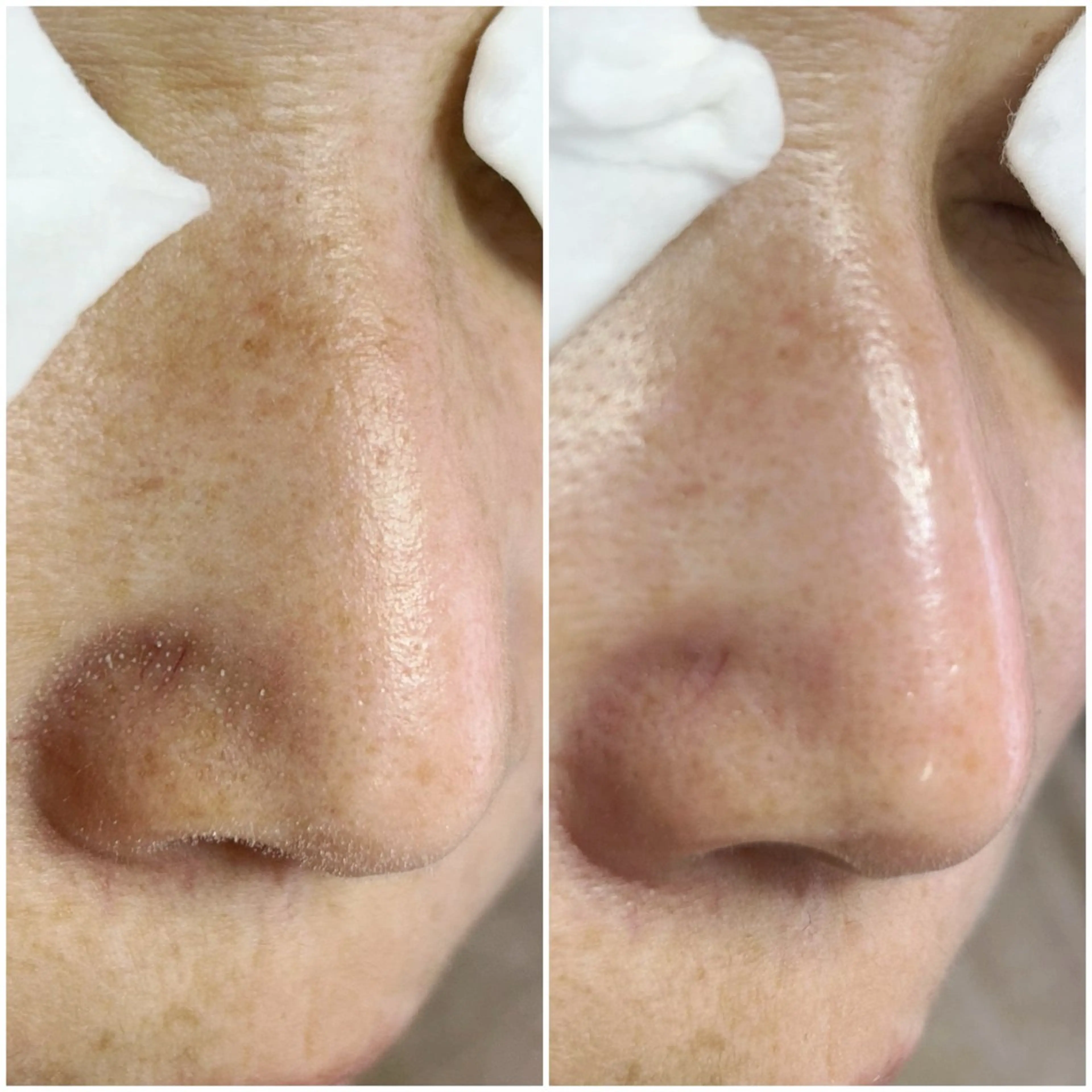 毛穴洗浄専門店/ 泉佐野/oluoluのエステ・リラクイメージ