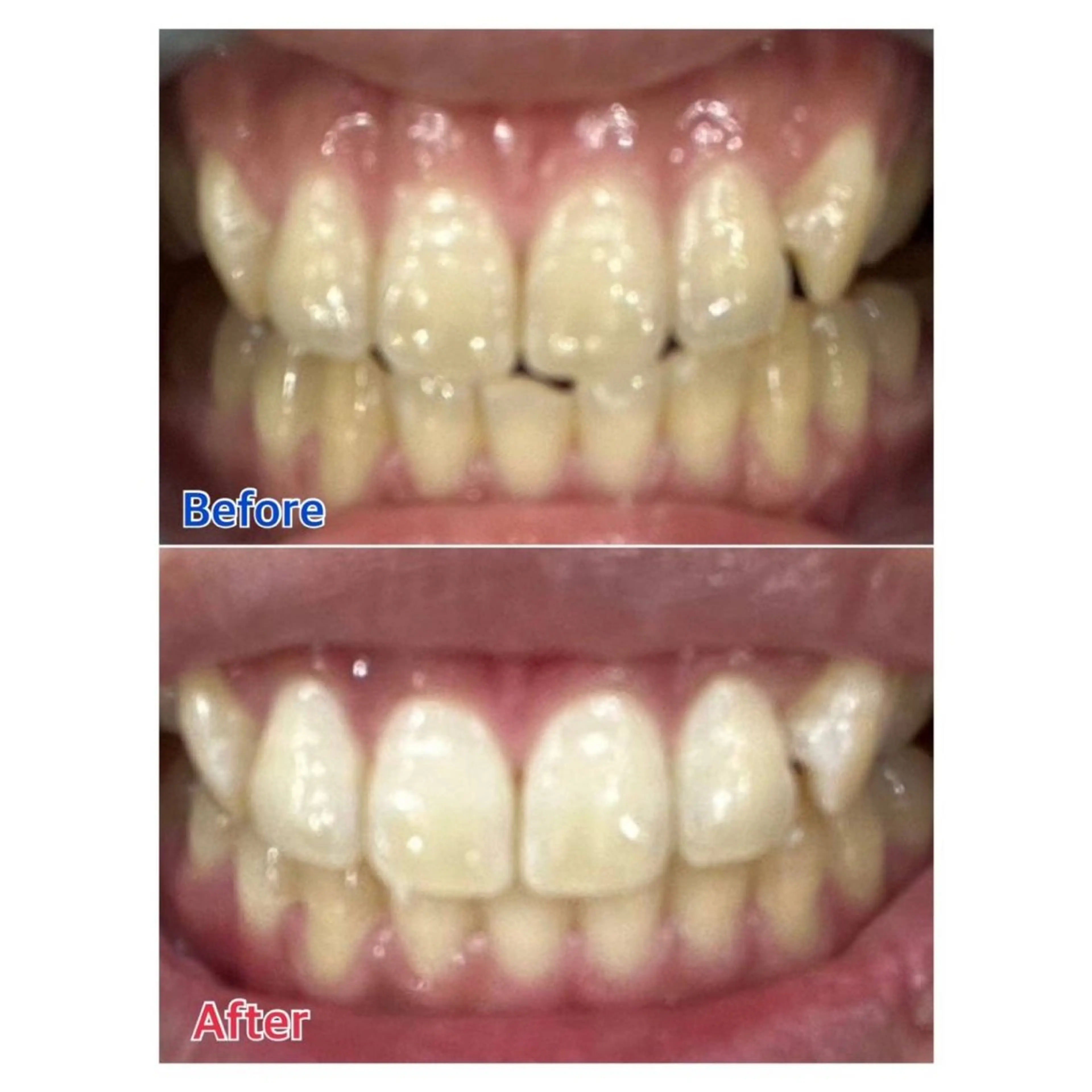 MBEAUTYSALON 千葉店・京成大久保所属・Melty 輝のその他イメージ