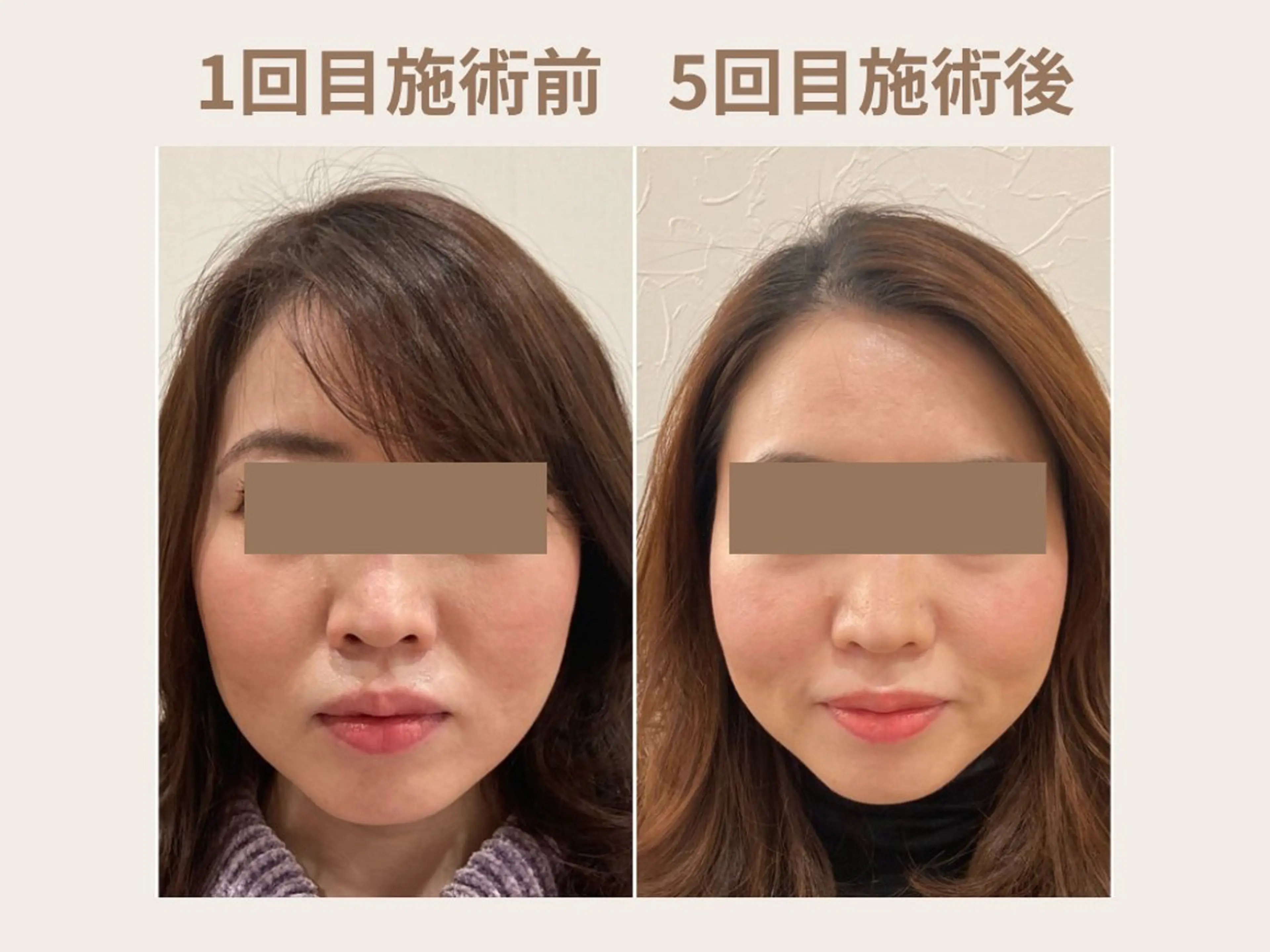 Momose Hanaのエステ・リラクイメージ