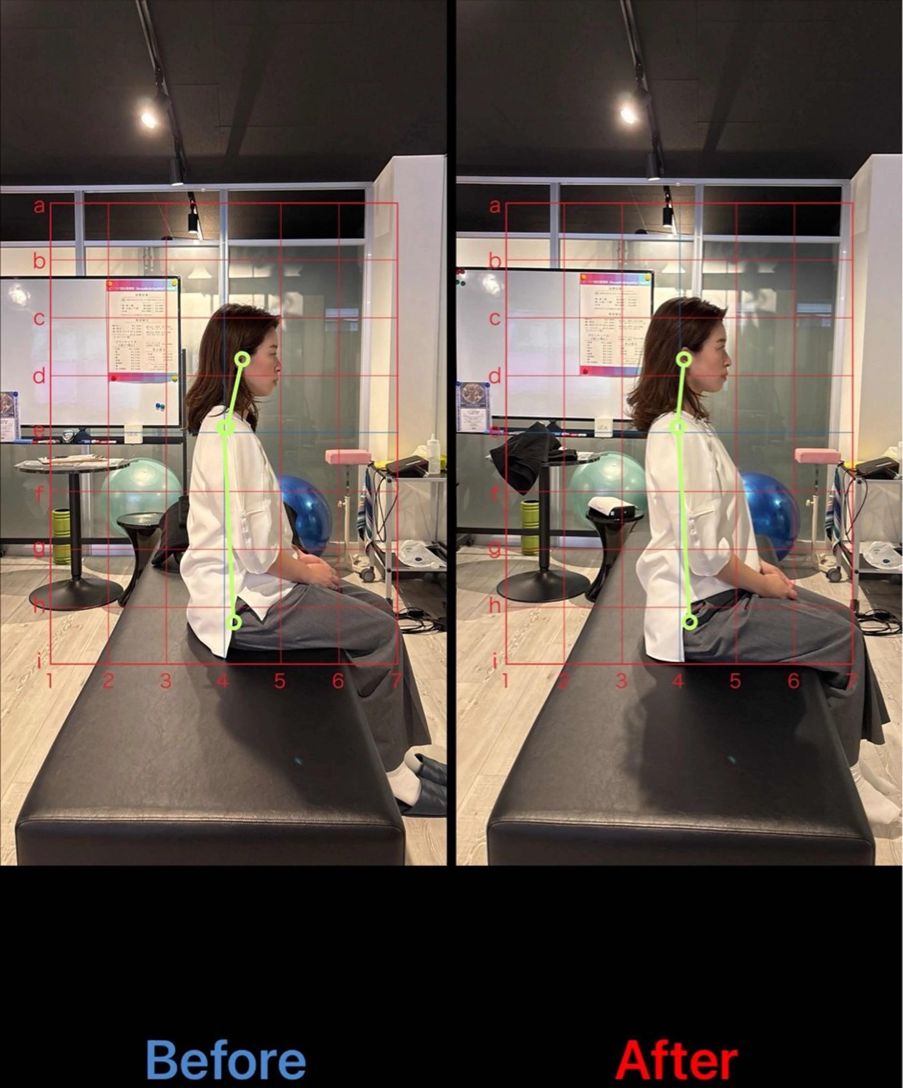【枚方】大阪/肩こり/巻き肩/小顔◎美容鍼＋整体＋鍼灸60分<初回限定>の写真