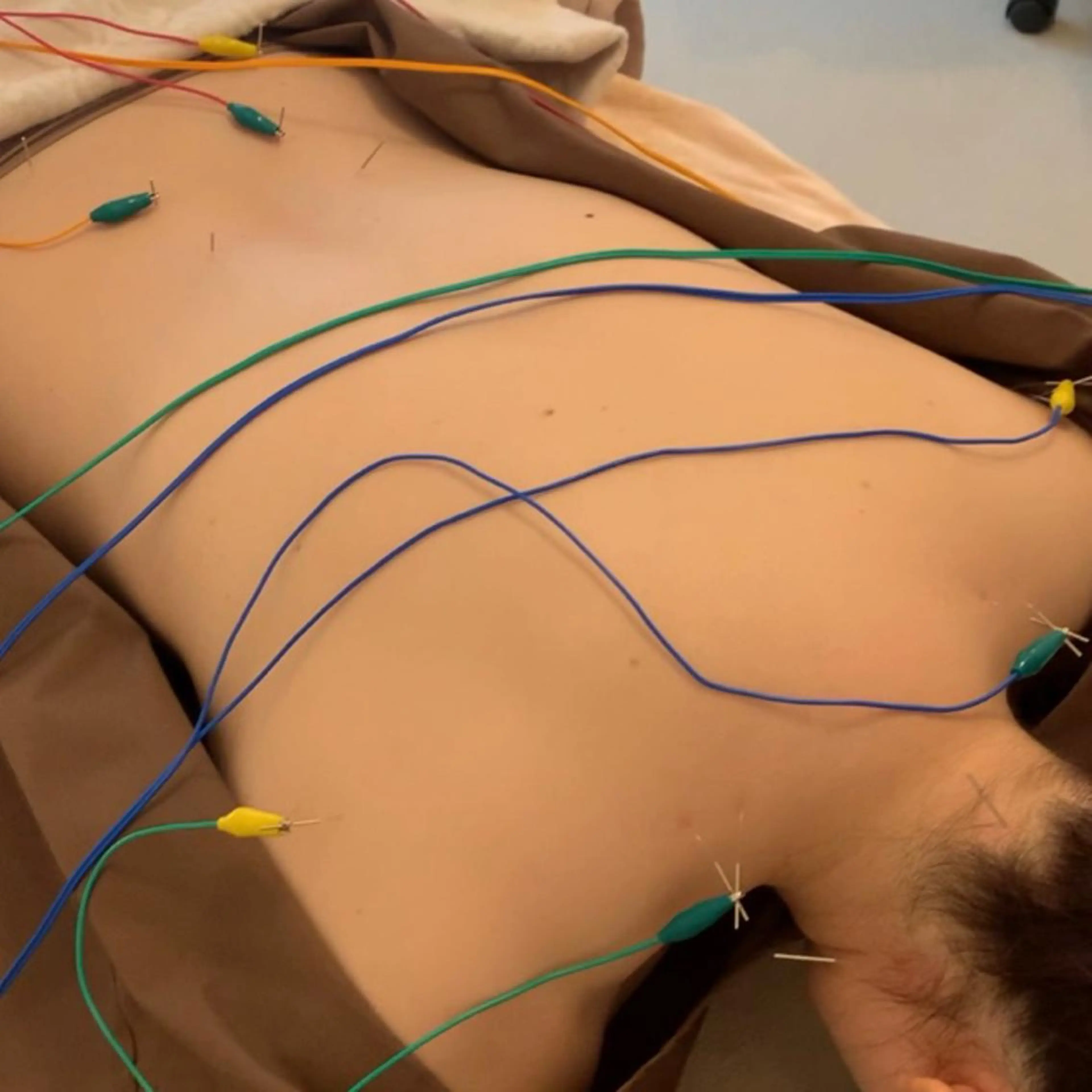 新宿hari-me所属・美容鍼hari-me 新宿のエステ・リラクイメージ