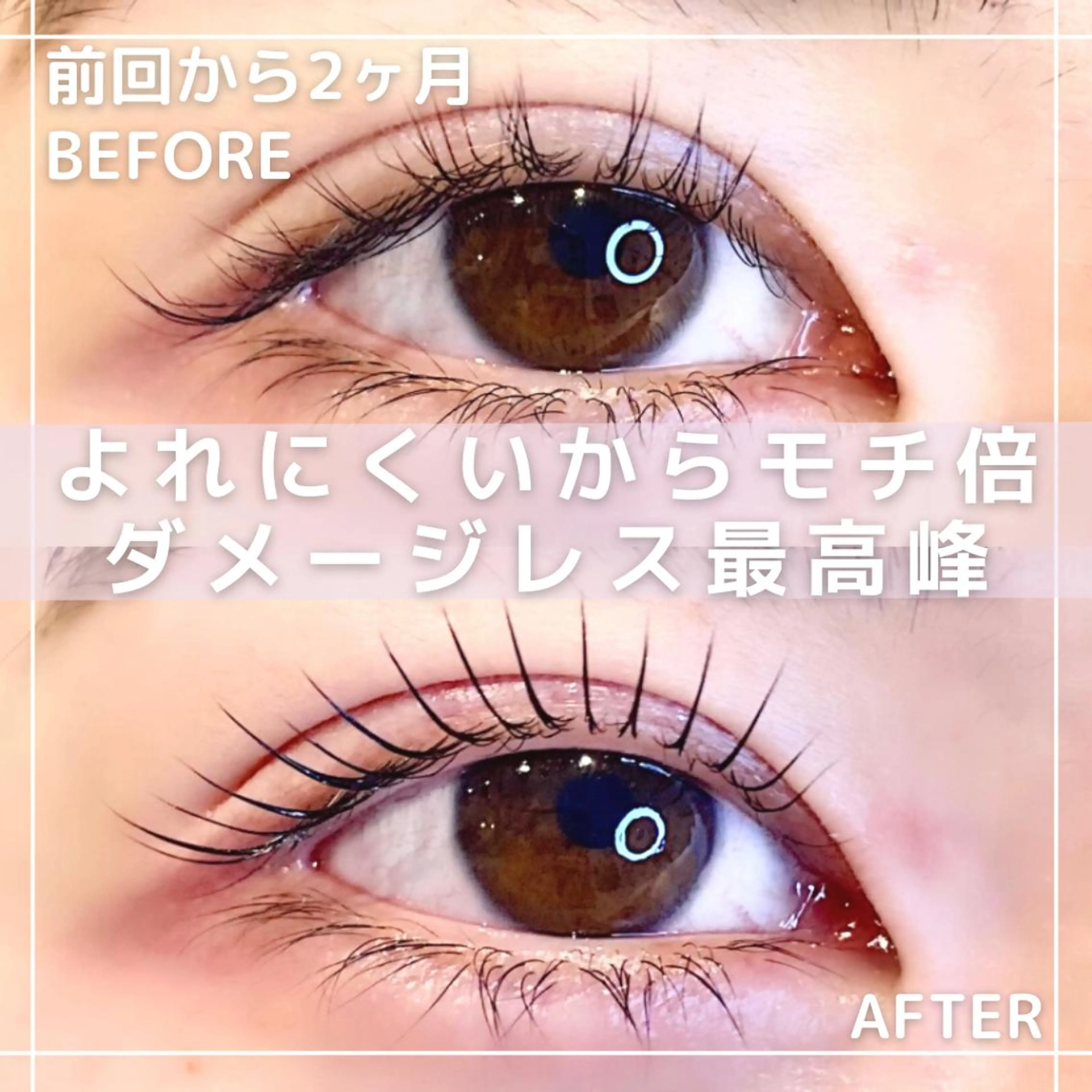 【ダメージレス最高峰/モチ1.5-2倍】アップフォースリフト(まつパ)の写真