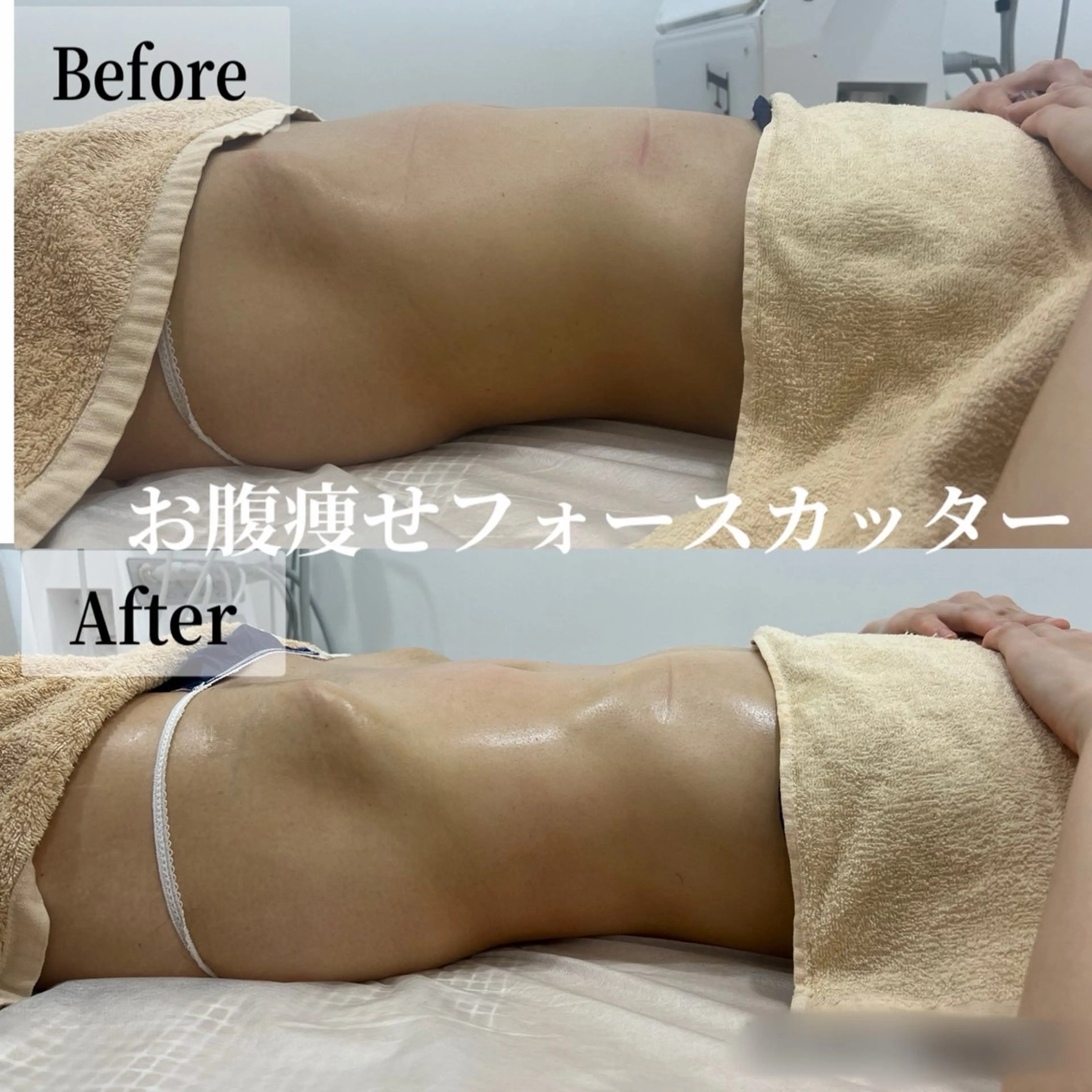 エステ ブライダル痩身×脱毛 尼崎駅前サロンのエステ・リラクイメージ