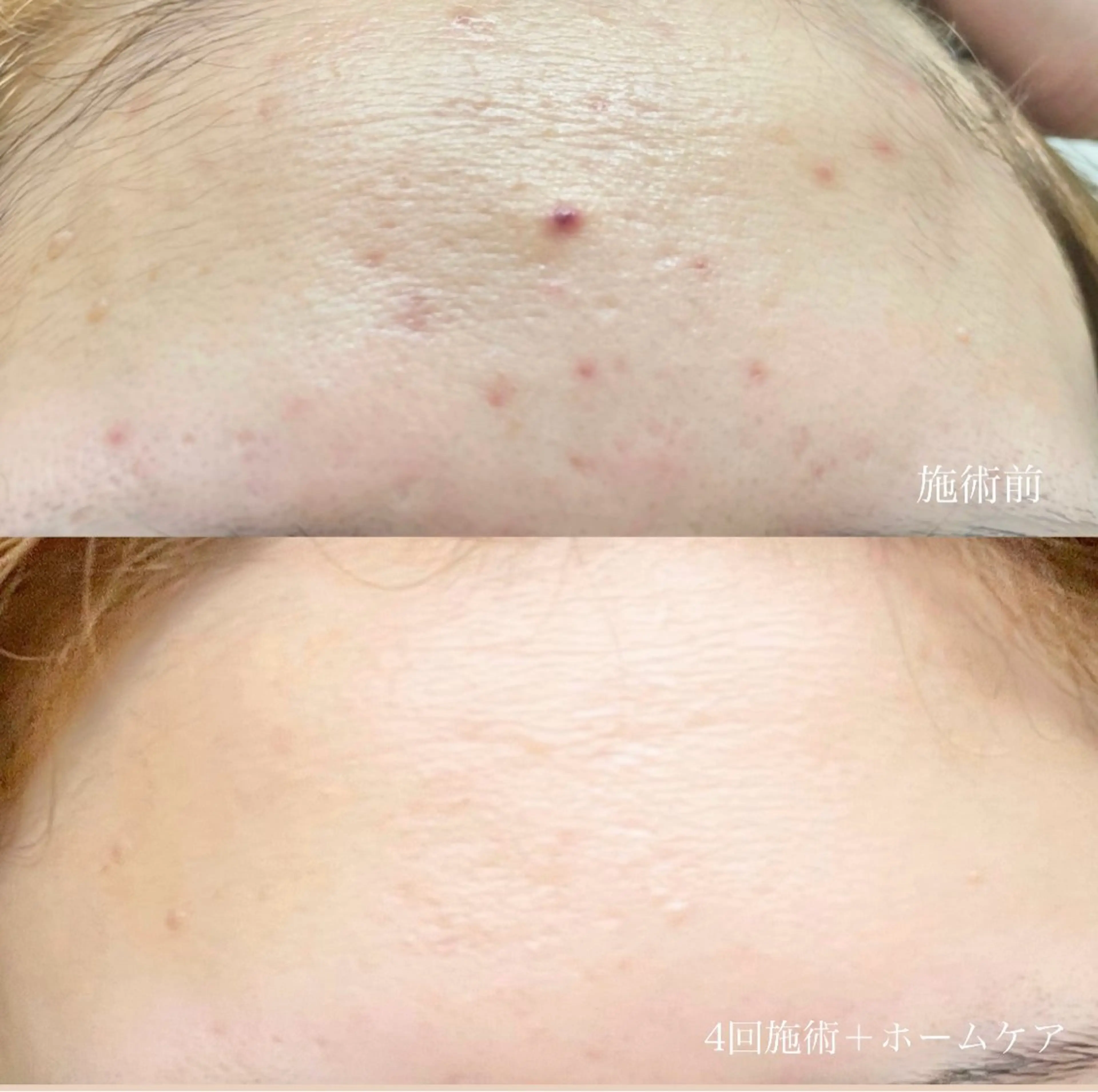 エステ beauty salon Belle所属・Belle【ベル】 YUKA⸜🌷︎⸝‍のエステ・リラクイメージ