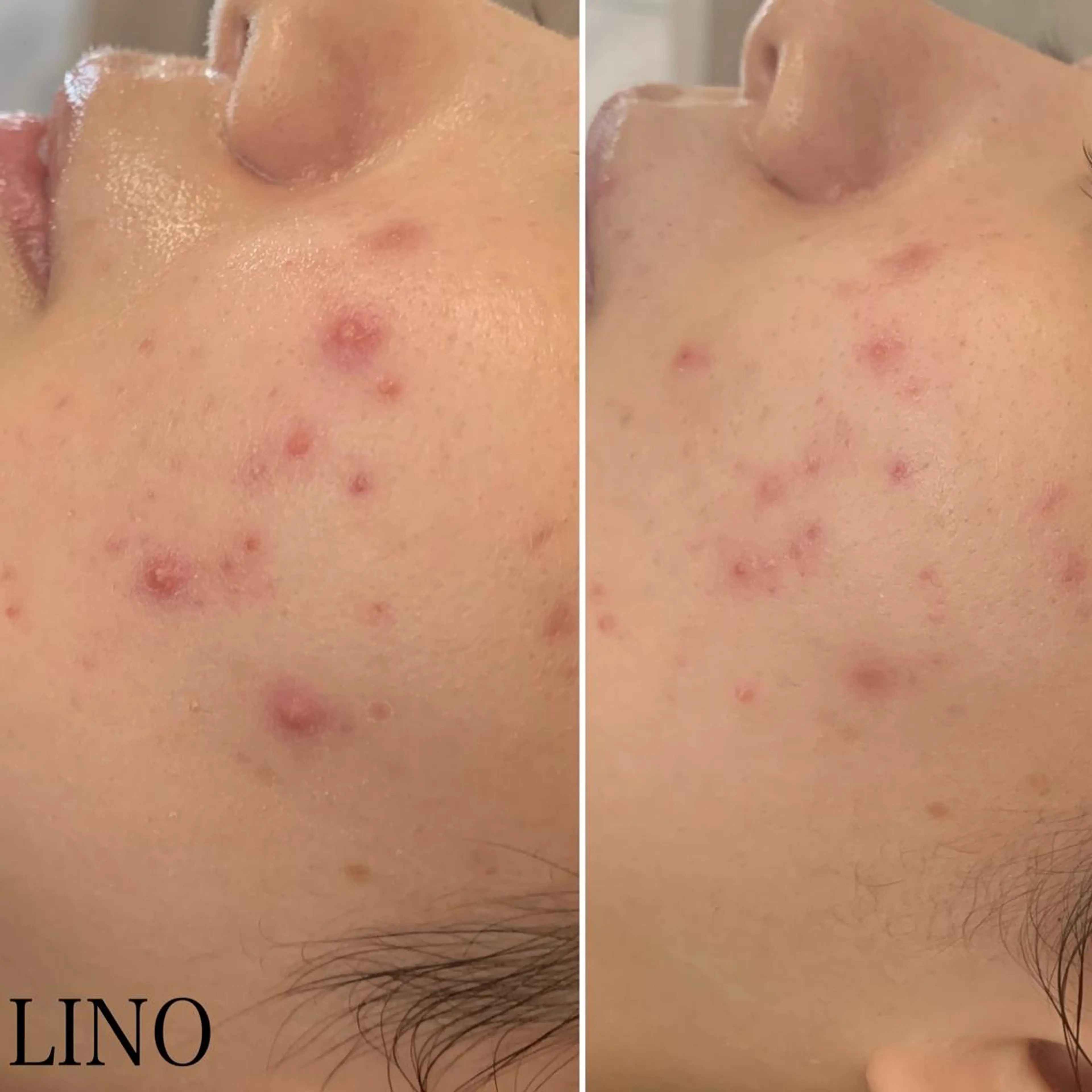 beautysalon  LINO所属・7月限定【平日限定】 全メニュ¥4,400のエステ・リラクイメージ