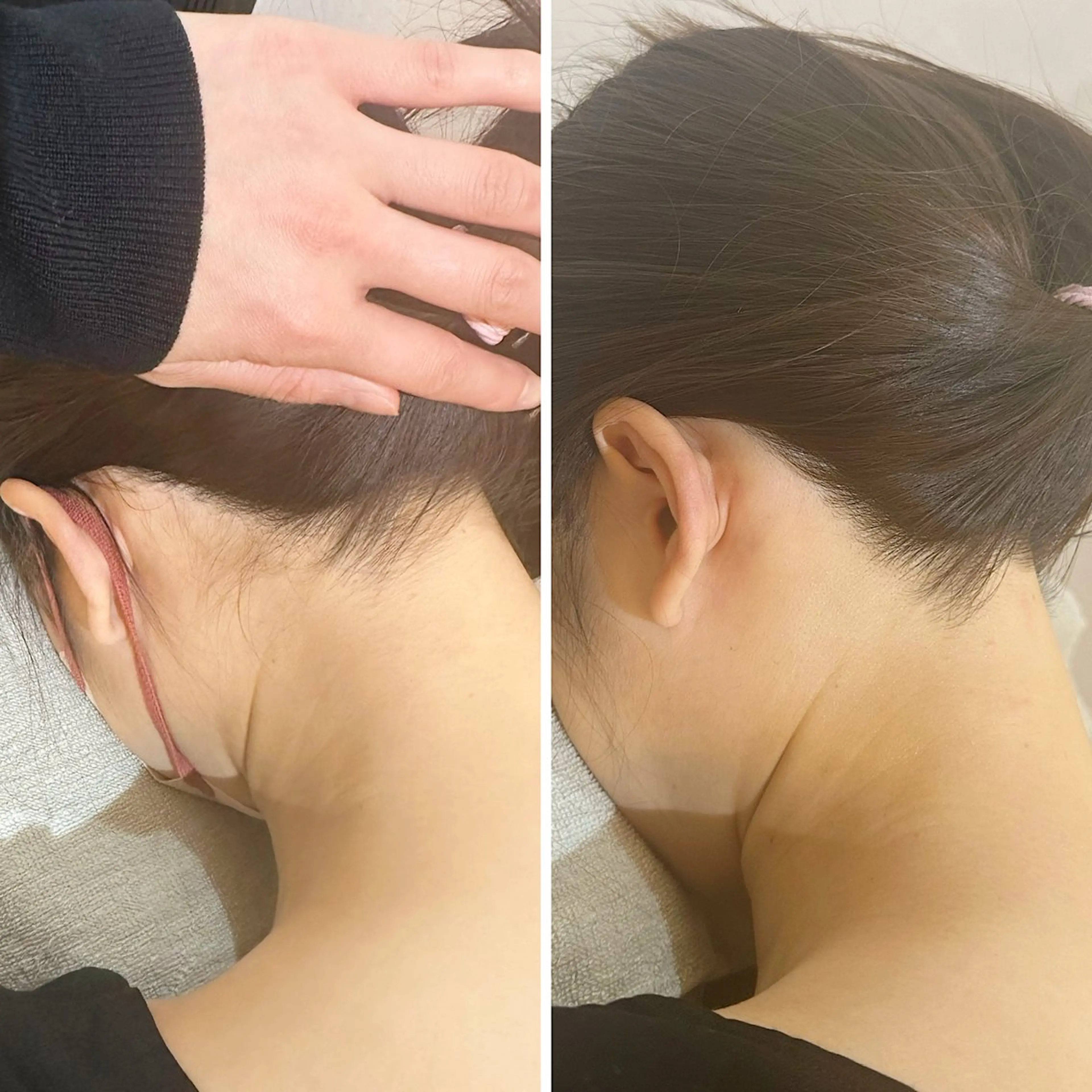 脱毛 うなじ脱毛/美肌脱毛 LABELのエステ・リラクイメージ