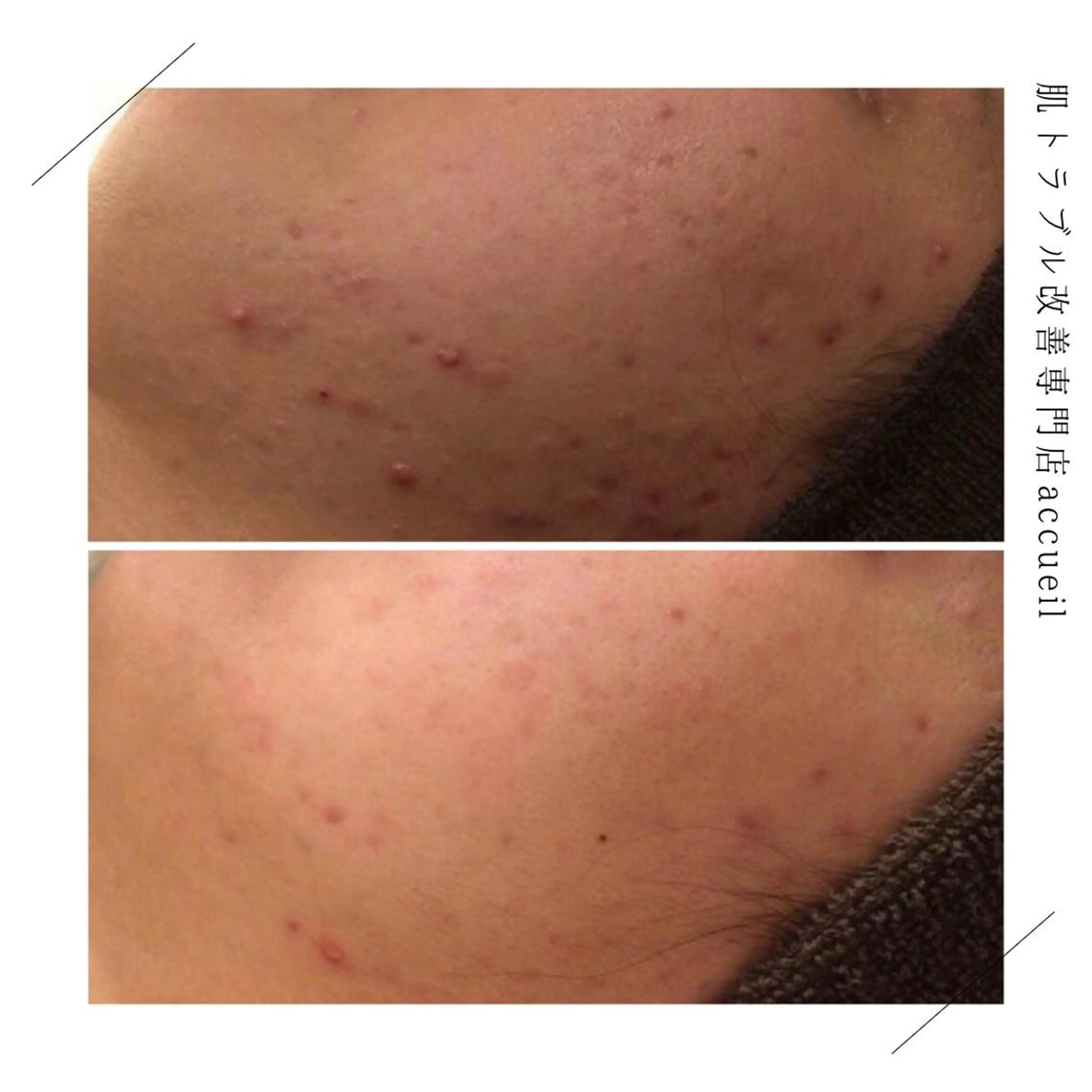 ミディアム カラー パーマ ヘアアレンジ メンズ キッズ ネイル マツエク・マツパ アイブロウ 触れたくなる モテ肌へ...❤︎のエステ・リラクイメージ