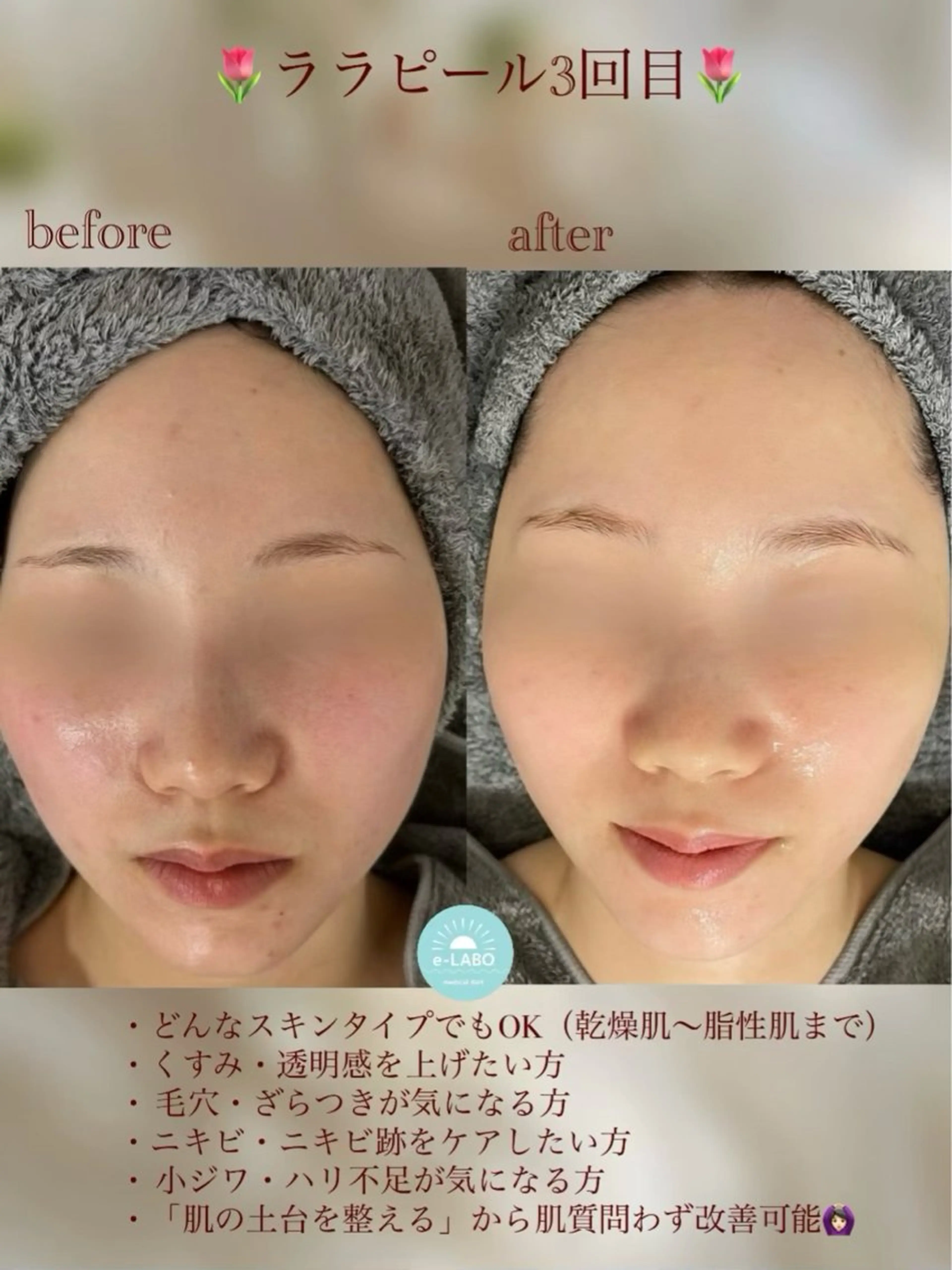 e-LABO こいずみのエステ・リラクイメージ