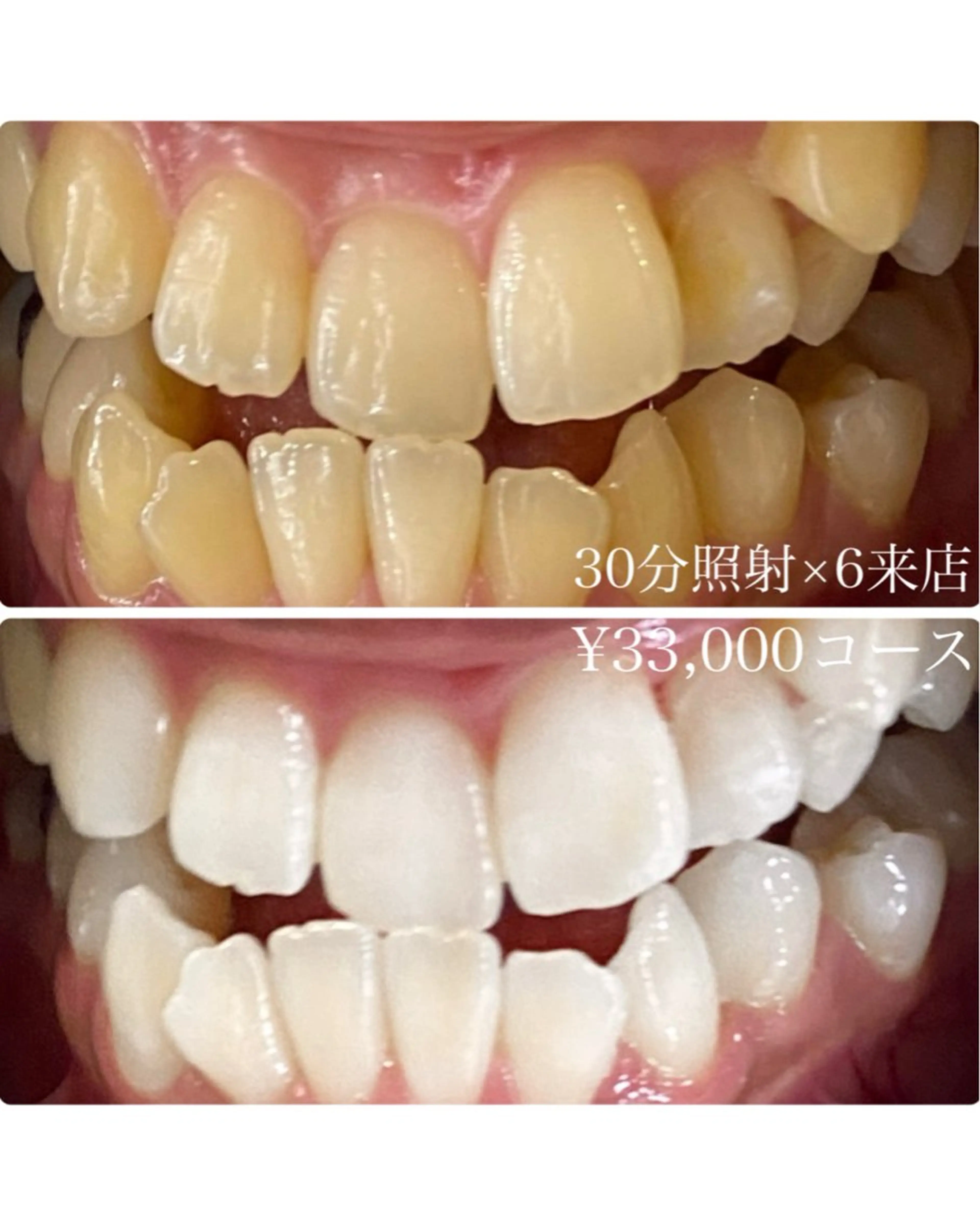 メンズ その他 ホワイトニングルーム　川崎店所属・ホワイトニング ルーム　川崎店のその他イメージ