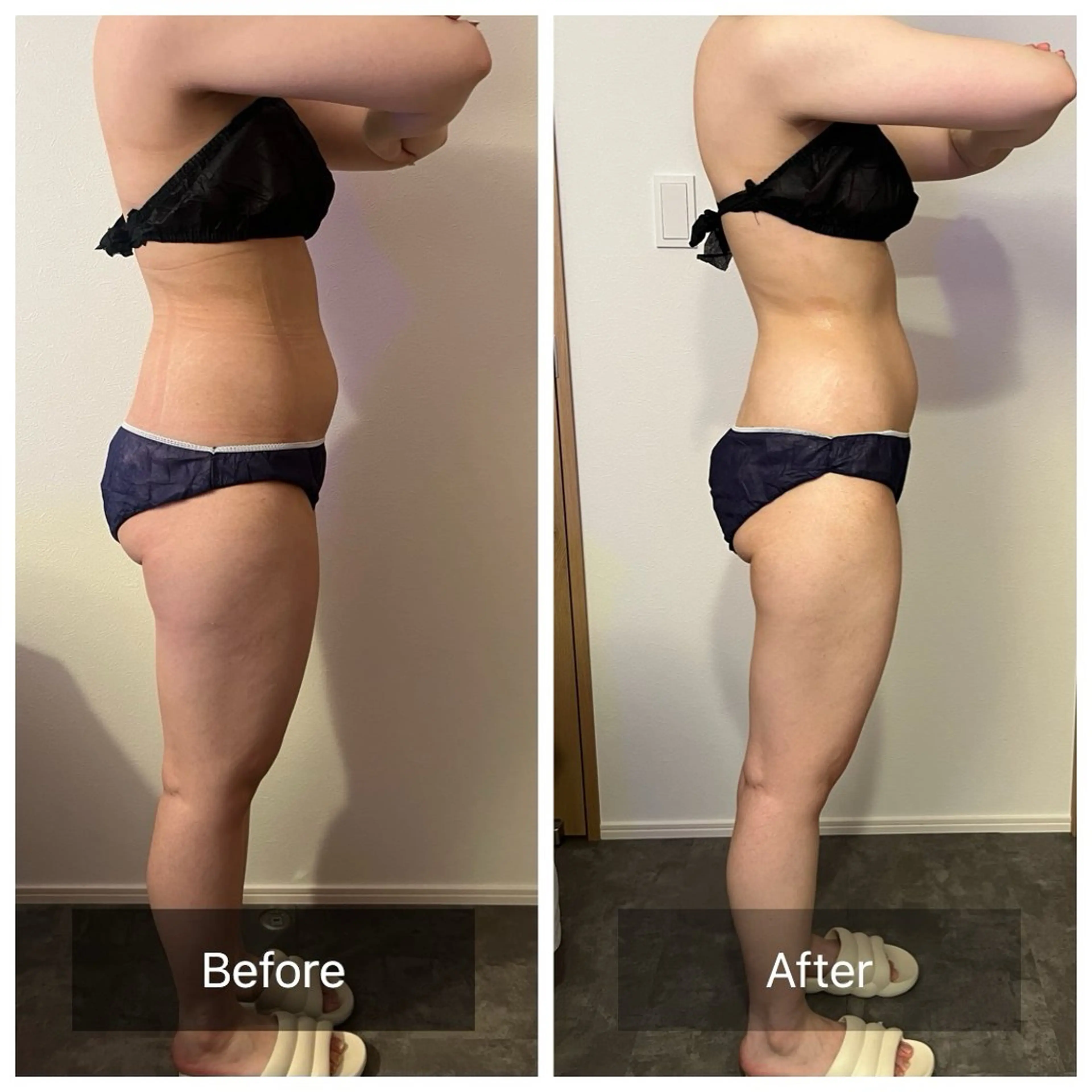 本気で痩せたい方へ 痩身専門サロンのその他イメージ