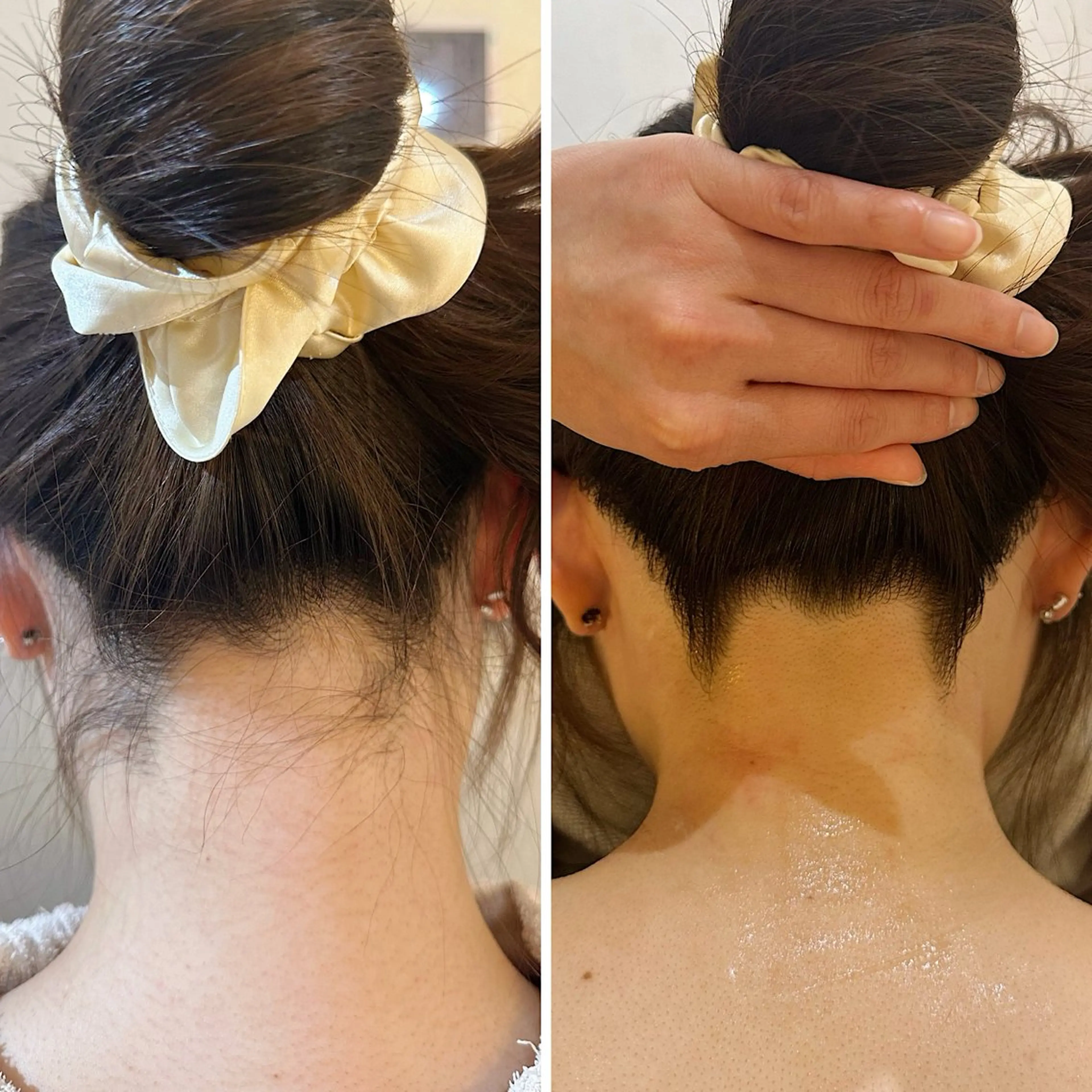 脱毛 うなじ脱毛/美肌脱毛 LABELのエステ・リラクイメージ